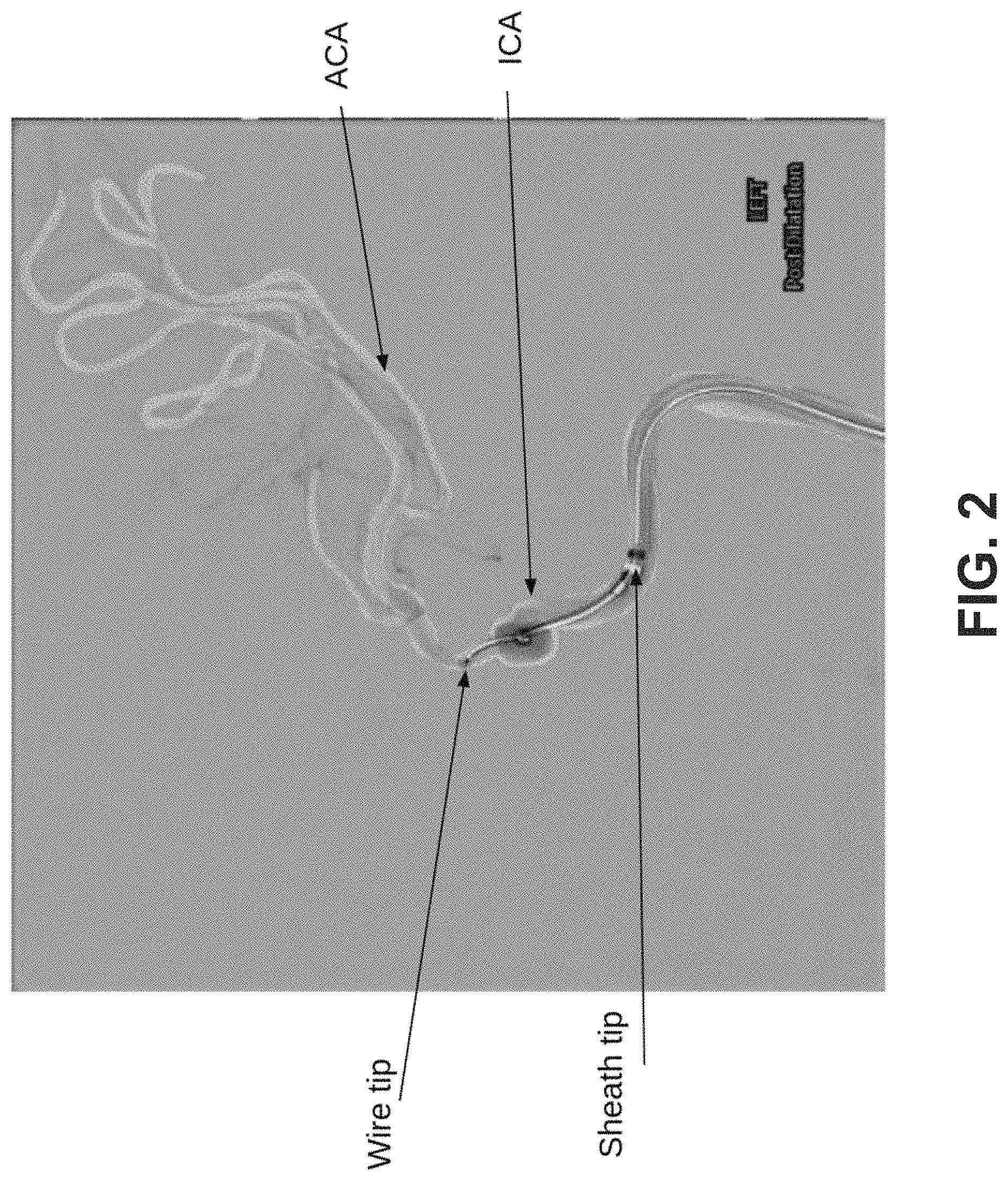 Patent US11779406 Figure 2 – Systems and methods for guidance of intraluminal devices within the vasculature
