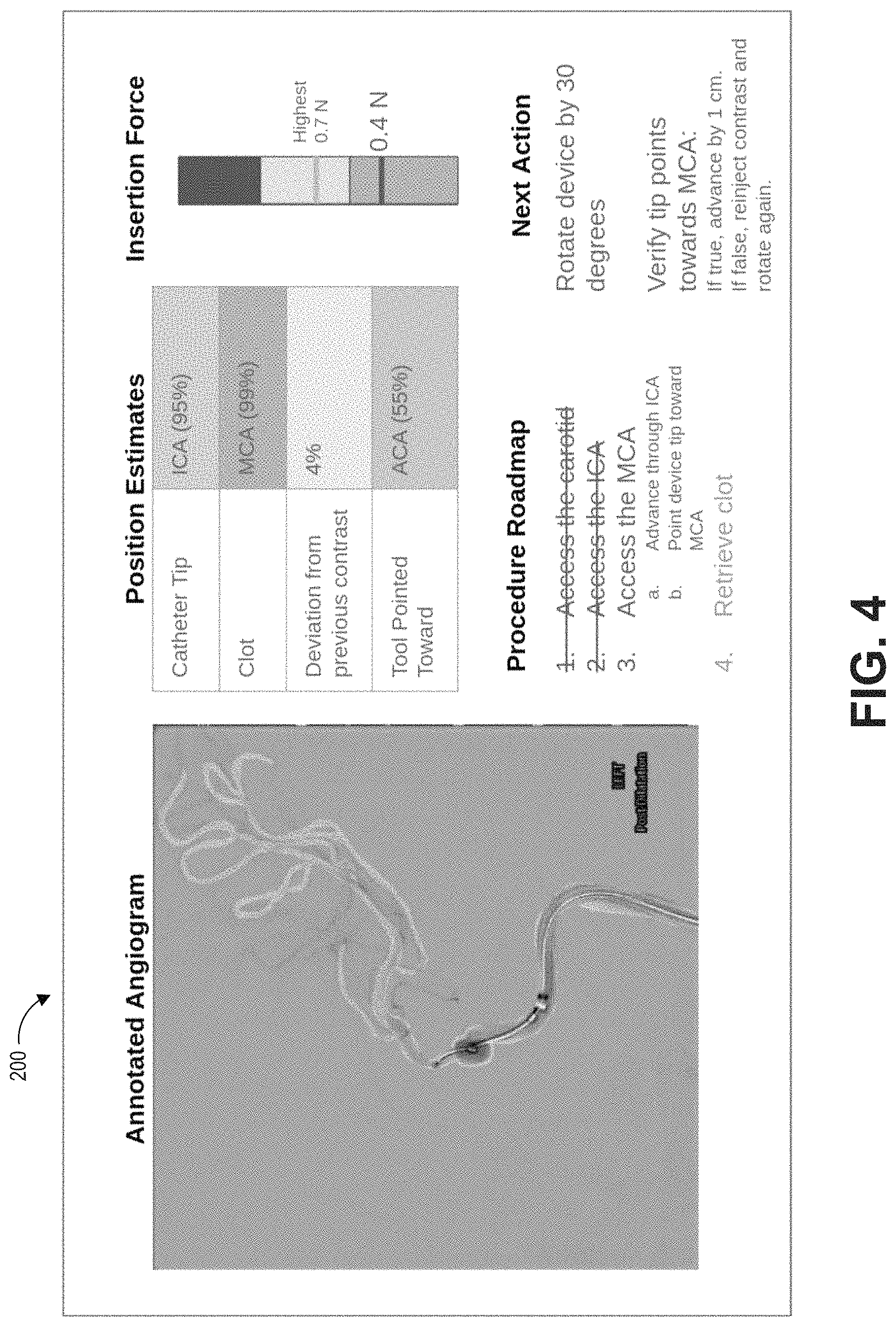 Patent US11779406 Figure 4 – Systems and methods for guidance of intraluminal devices within the vasculature