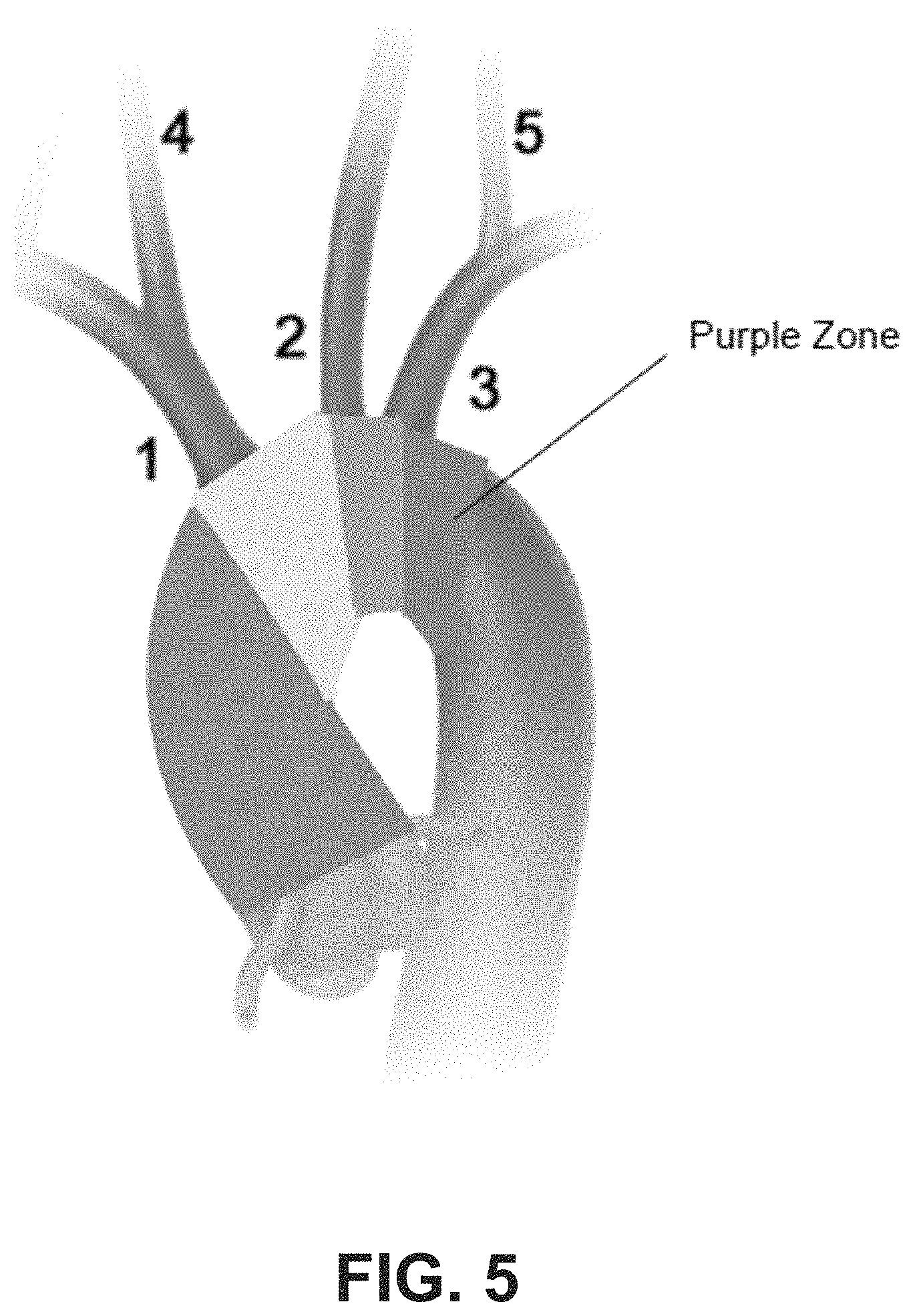 Patent US11779406 Figure 5 – Systems and methods for guidance of intraluminal devices within the vasculature
