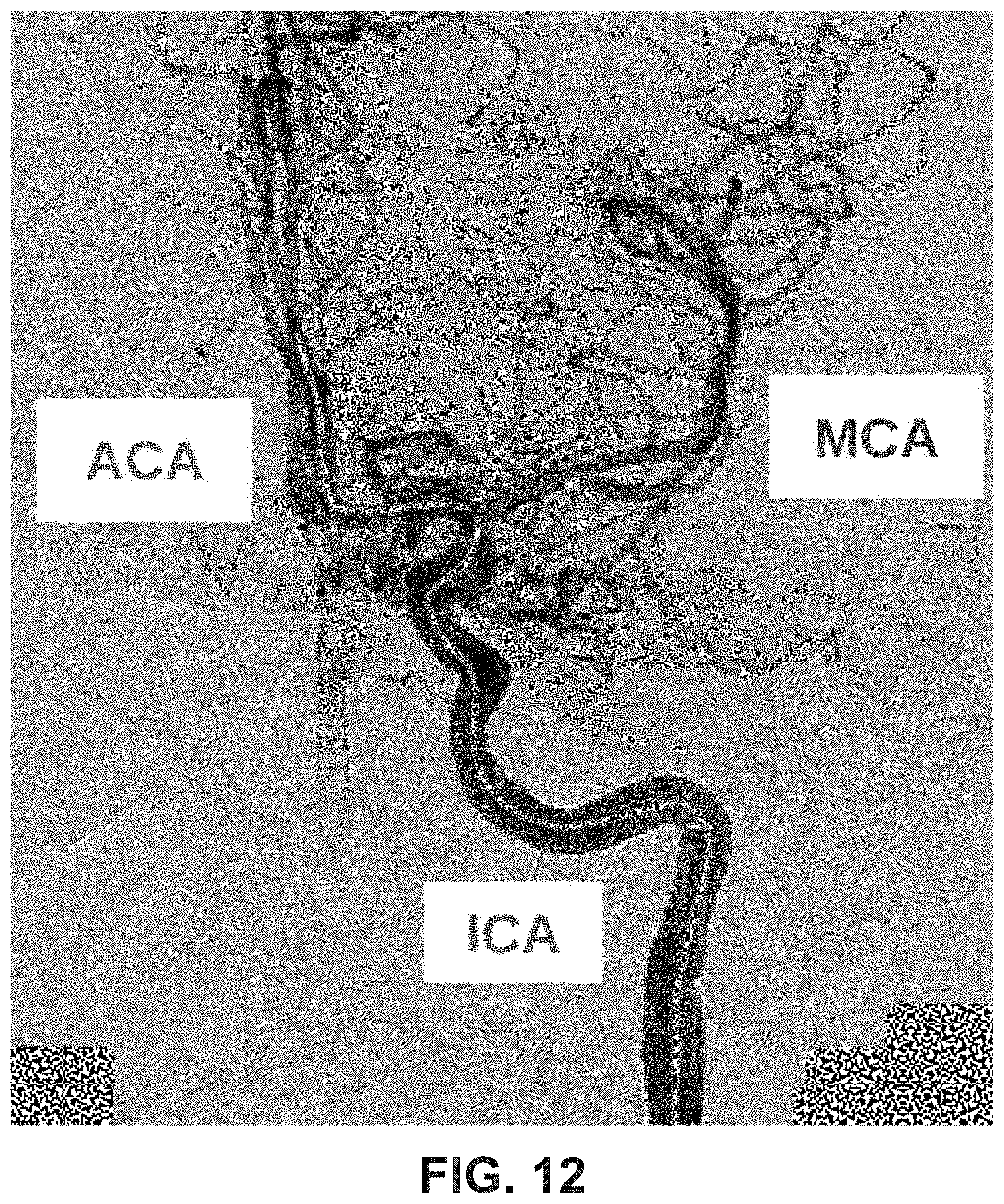 Patent US11779406 Figure 15 – Systems and methods for guidance of intraluminal devices within the vasculature