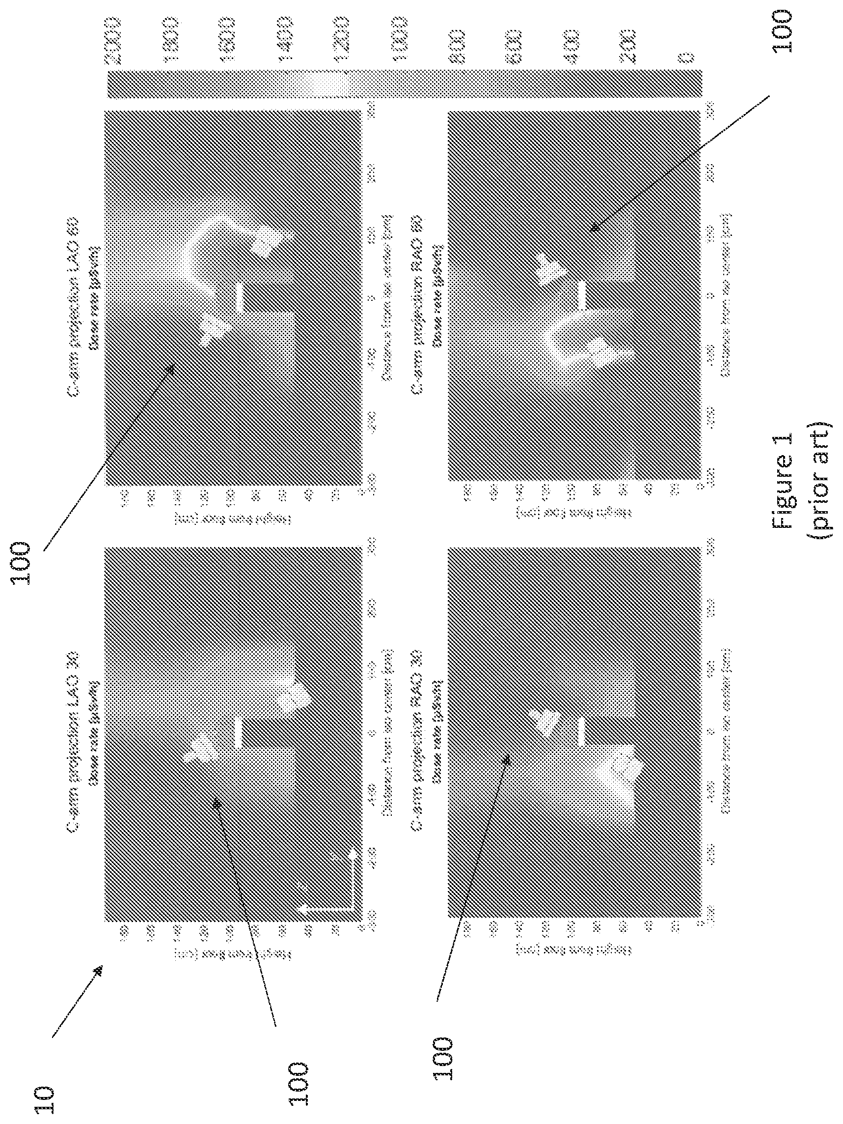 Patent US11779407 — Monitoring medical procedures by estimated radiation exposure — Figure 1
