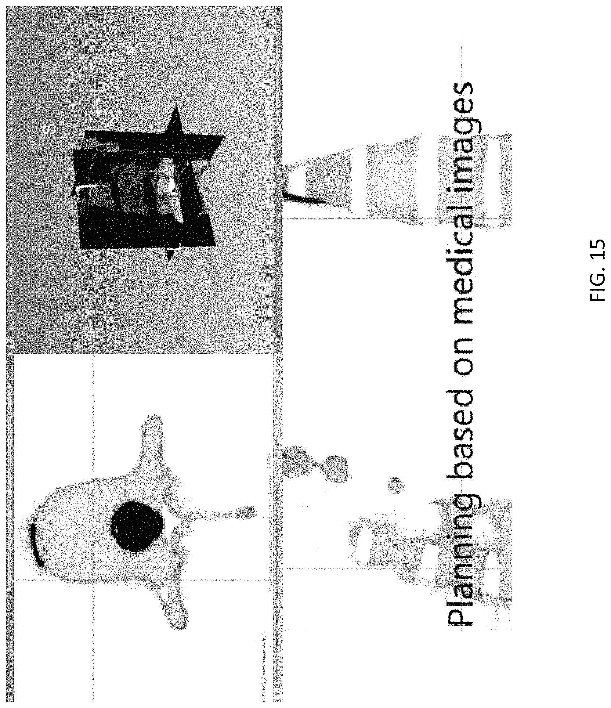 Patent US11779408 Figure 15 – Robotic navigation of robotic surgical systems