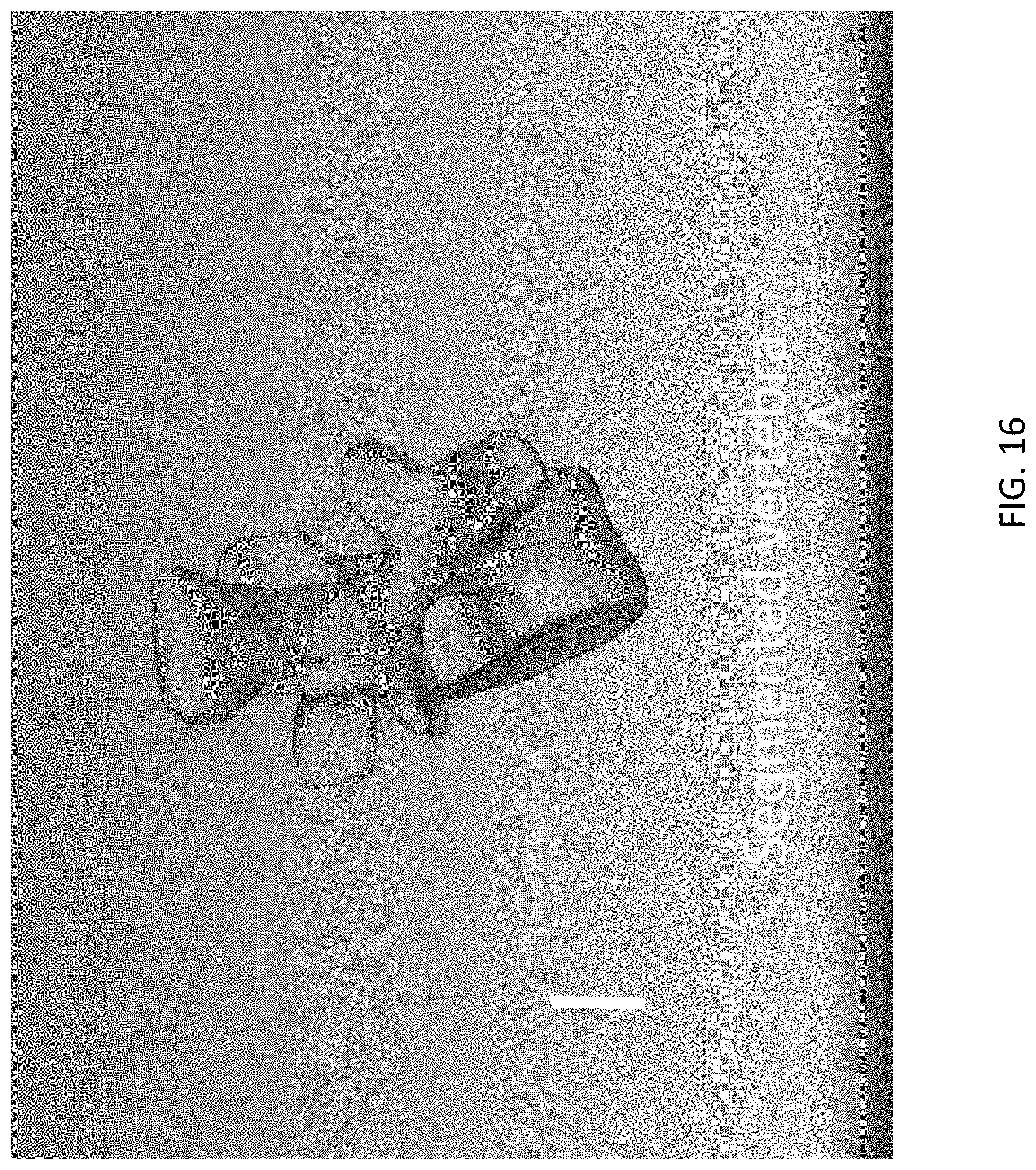 Patent US11779408 Figure 16 – Robotic navigation of robotic surgical systems