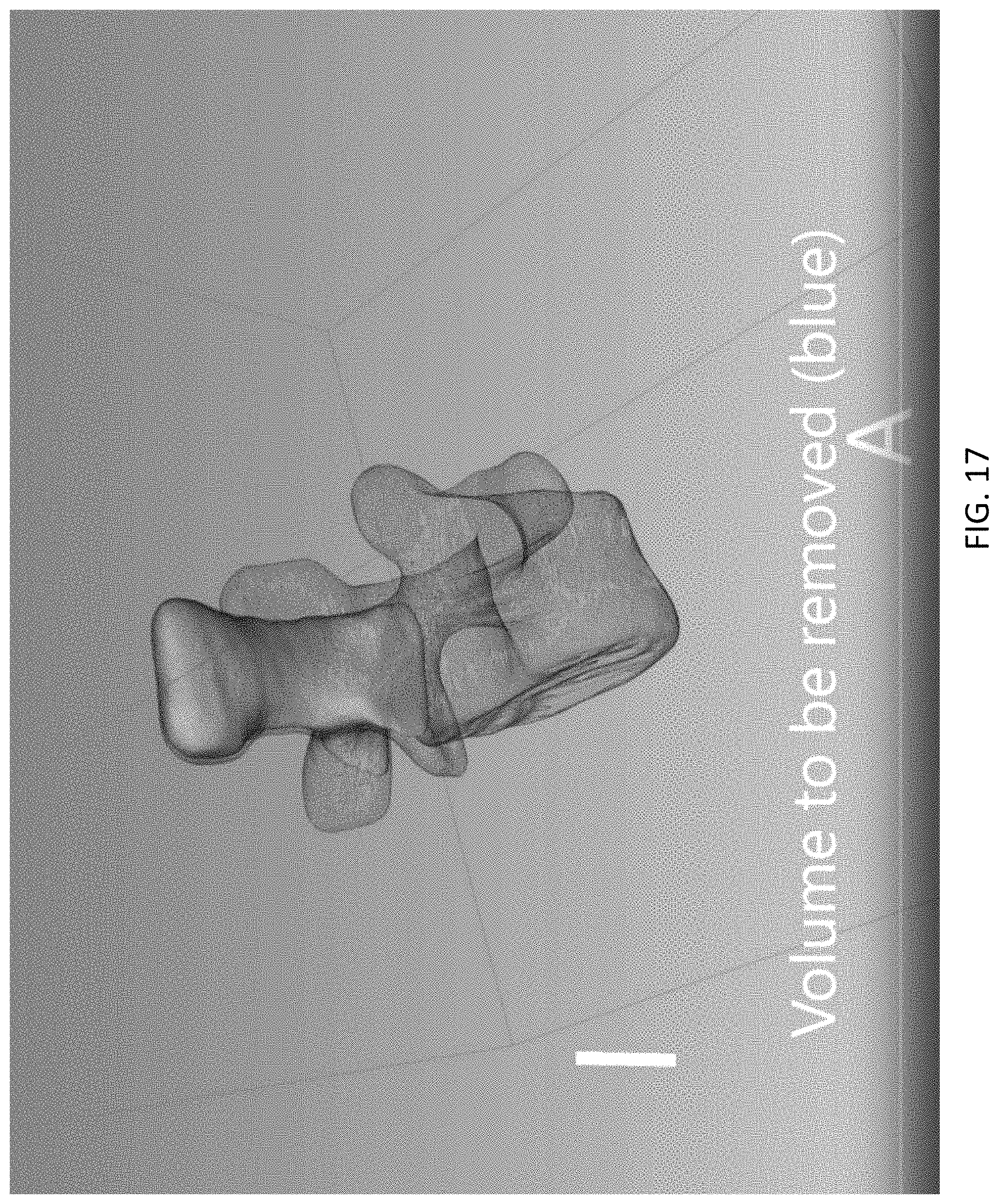 Patent US11779408 Figure 17 – Robotic navigation of robotic surgical systems