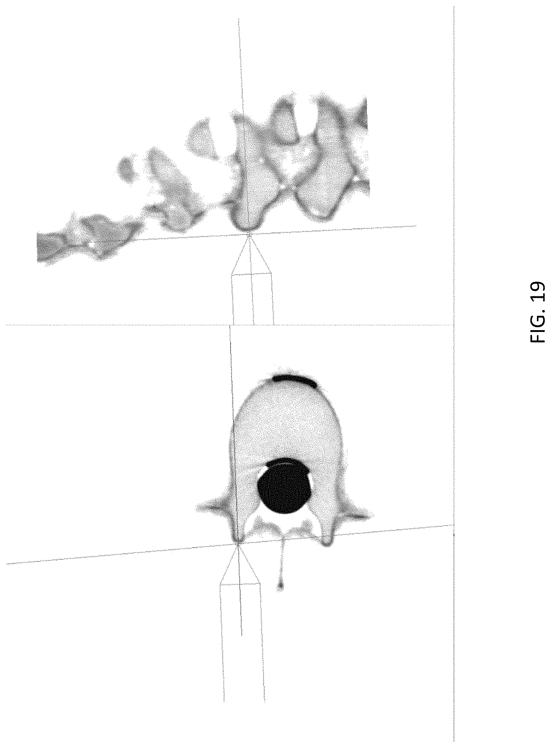 Patent US11779408 Figure 19 – Robotic navigation of robotic surgical systems