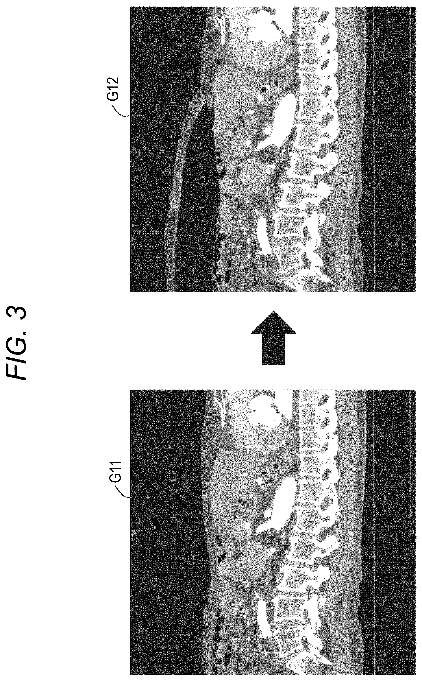 Patent US11779412 Figure 3 – Robotically-assisted surgical device, robotically-assisted surgery method, and system