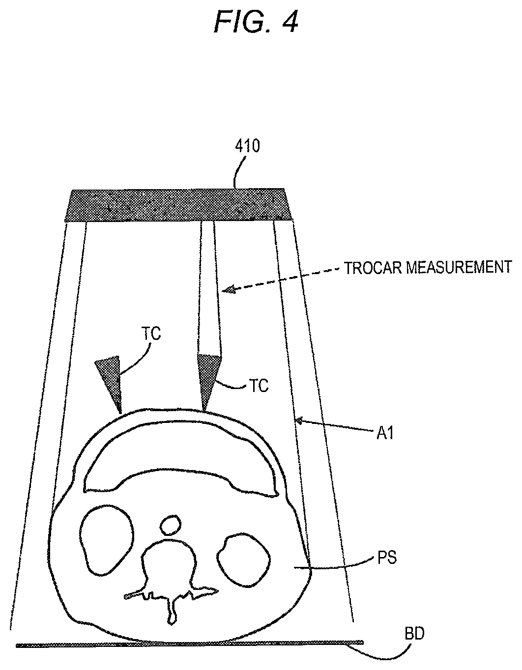 Patent US11779412 Figure 4 – Robotically-assisted surgical device, robotically-assisted surgery method, and system