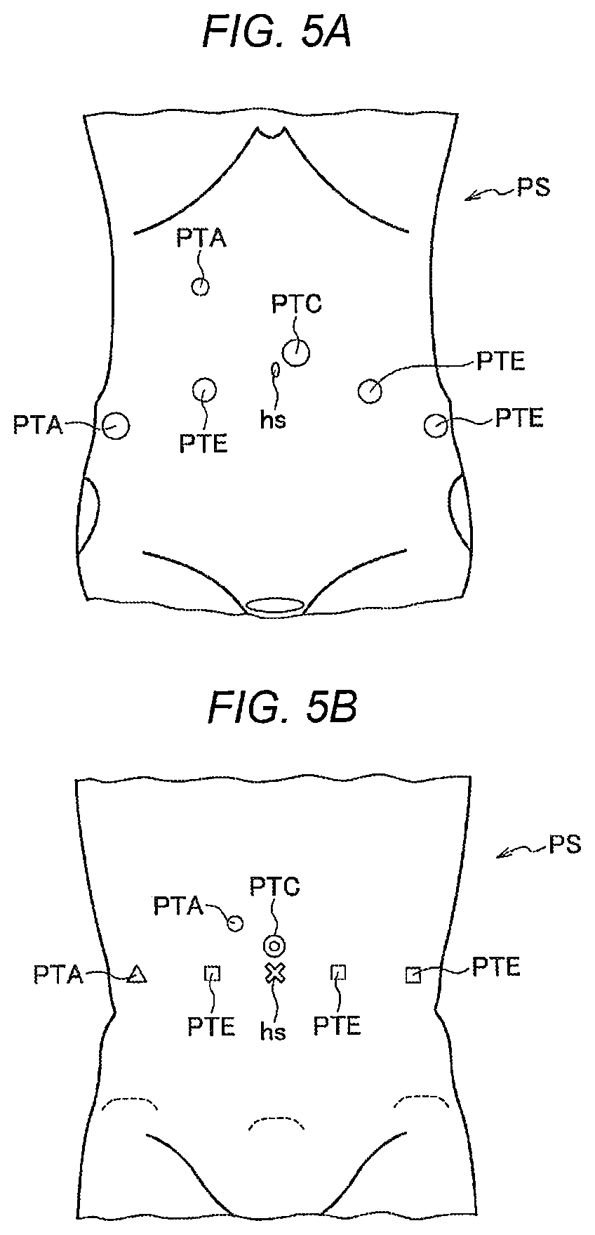 Patent US11779412 Figure 5 – Robotically-assisted surgical device, robotically-assisted surgery method, and system