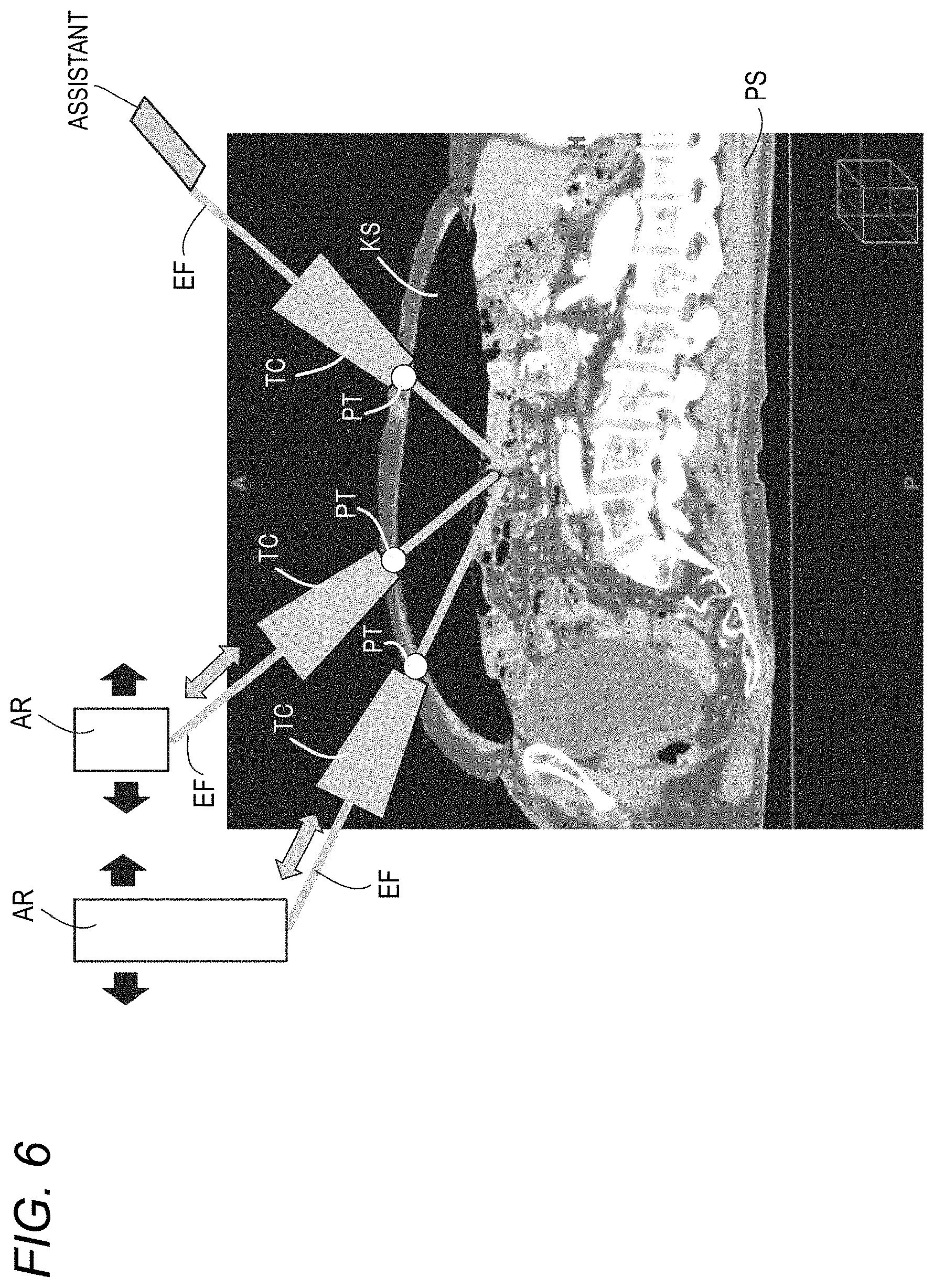 Patent US11779412 Figure 7 – Robotically-assisted surgical device, robotically-assisted surgery method, and system