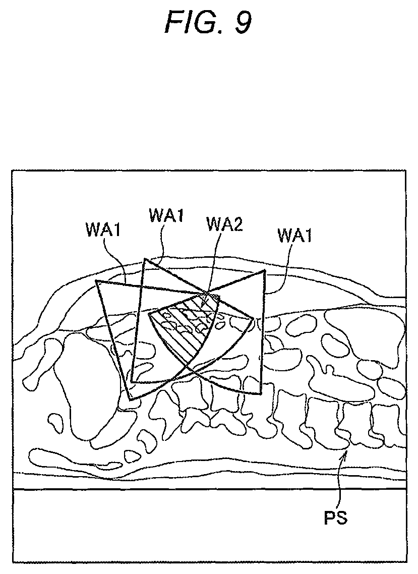 Patent US11779412 Figure 10 – Robotically-assisted surgical device, robotically-assisted surgery method, and system