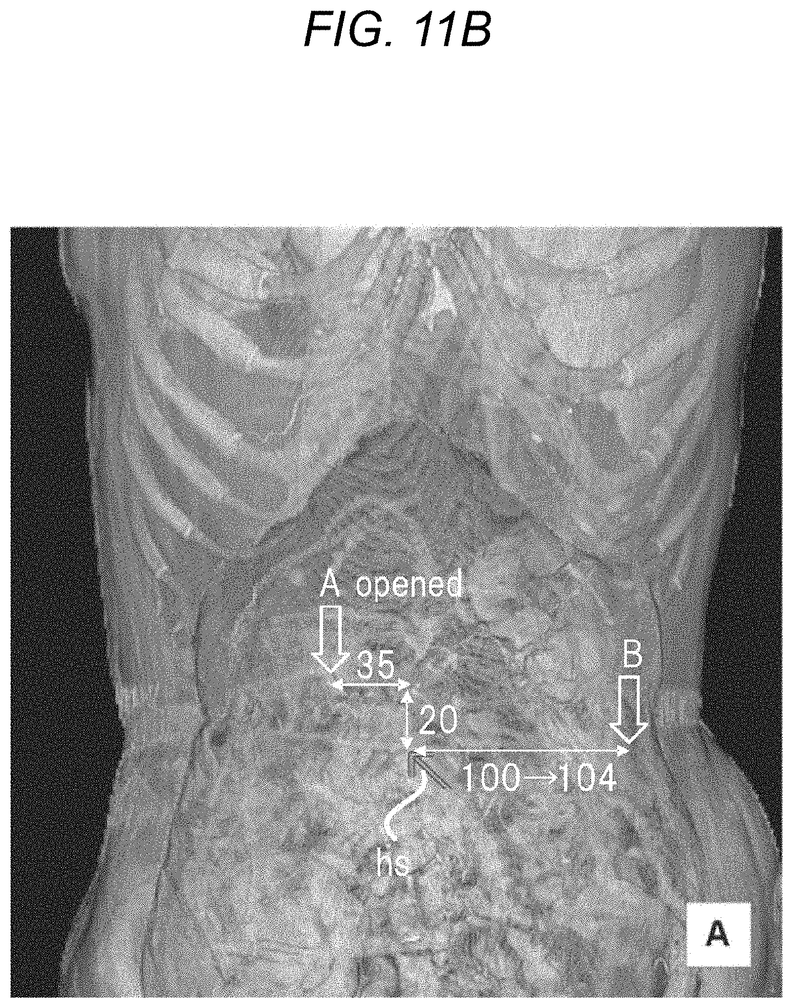 Patent US11779412 Figure 13 – Robotically-assisted surgical device, robotically-assisted surgery method, and system