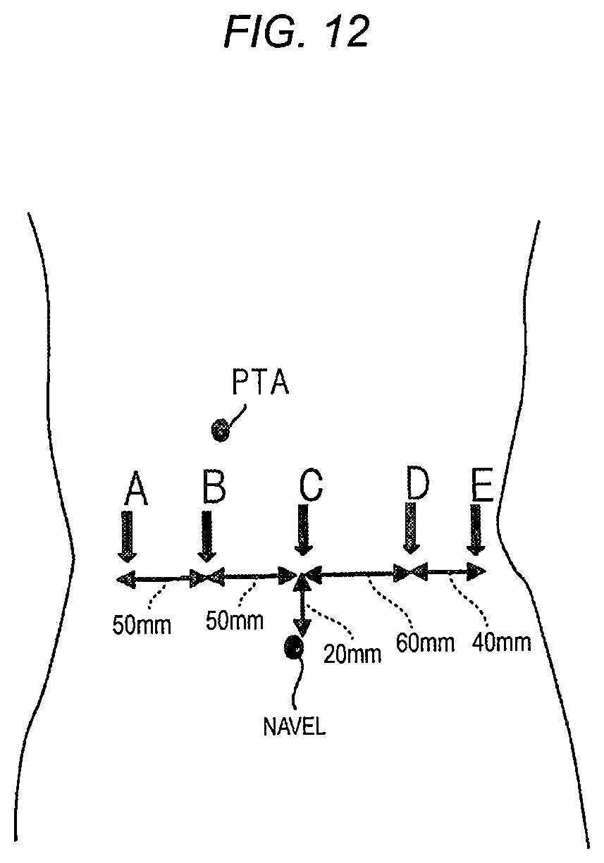 Patent US11779412 Figure 14 – Robotically-assisted surgical device, robotically-assisted surgery method, and system