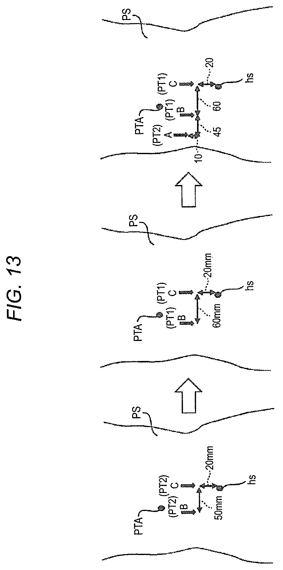 Patent US11779412 Figure 15 – Robotically-assisted surgical device, robotically-assisted surgery method, and system