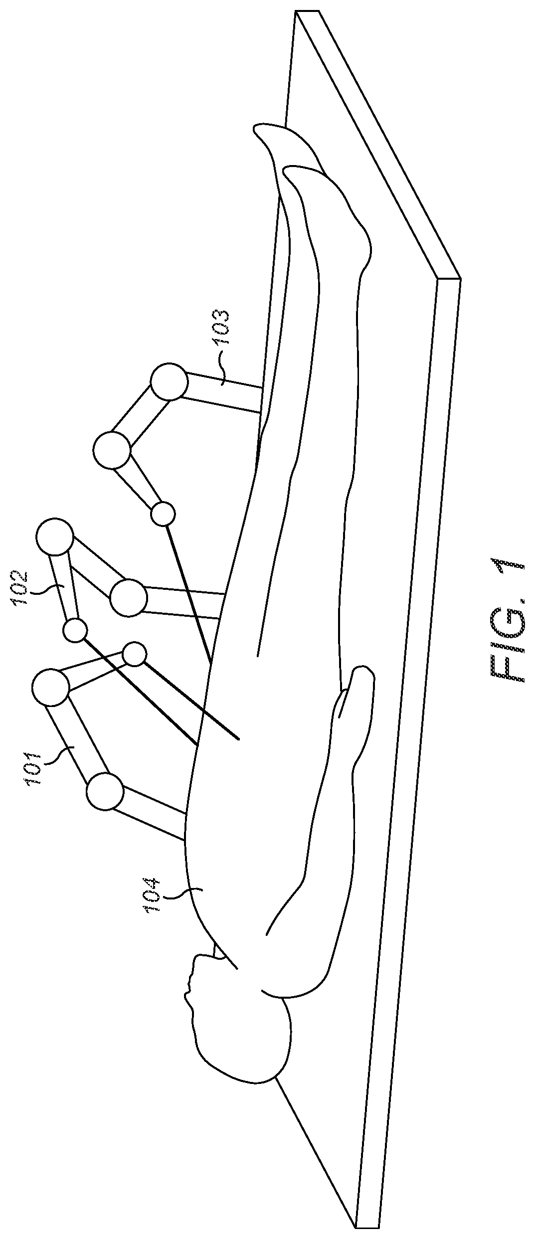 Patent US11779417 Figure 1 – Method of controlling a surgical robot