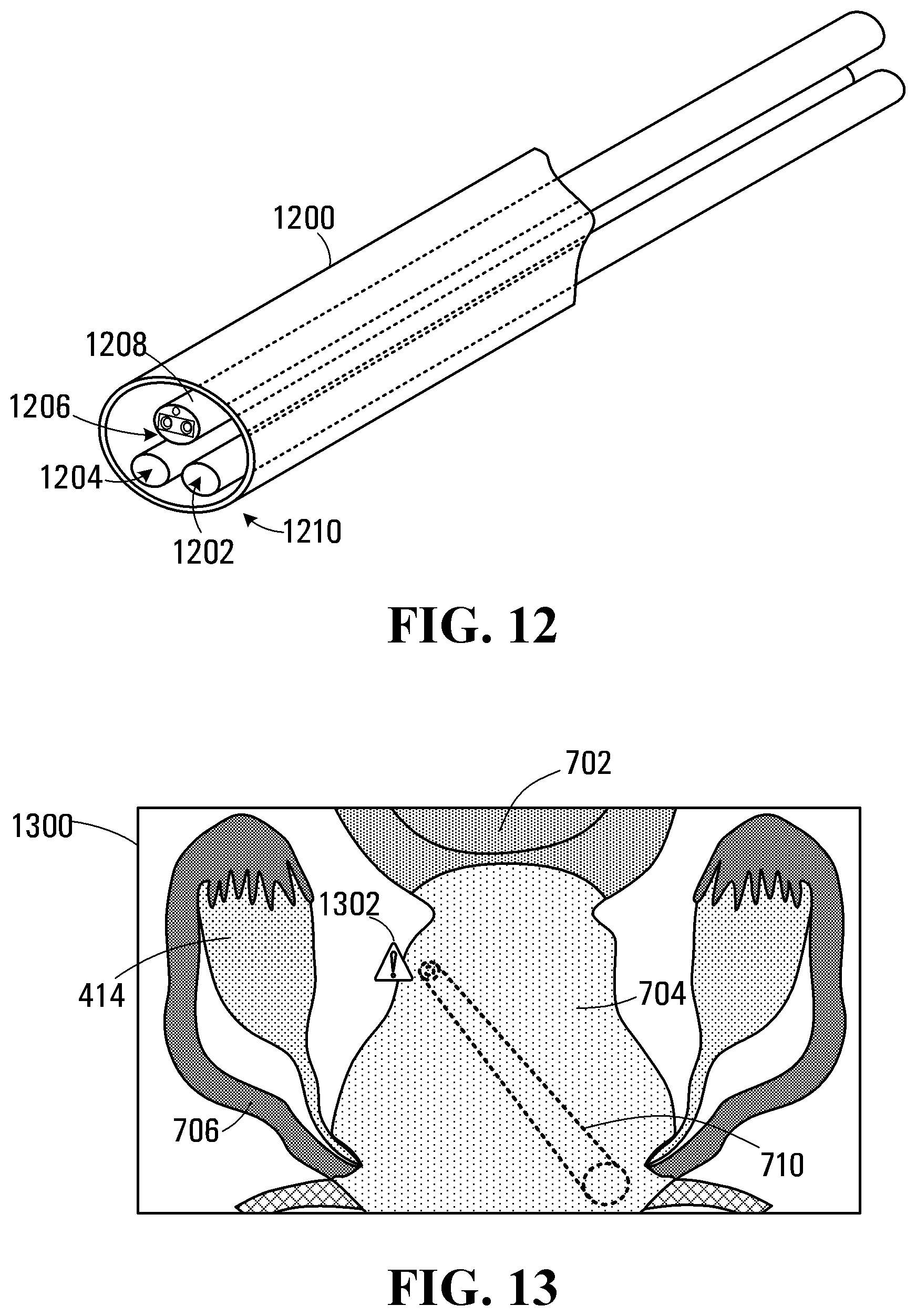 Patent US11779418 Figure 8 – System and apparatus for positioning an instrument in a body cavity for performing a surgical procedure