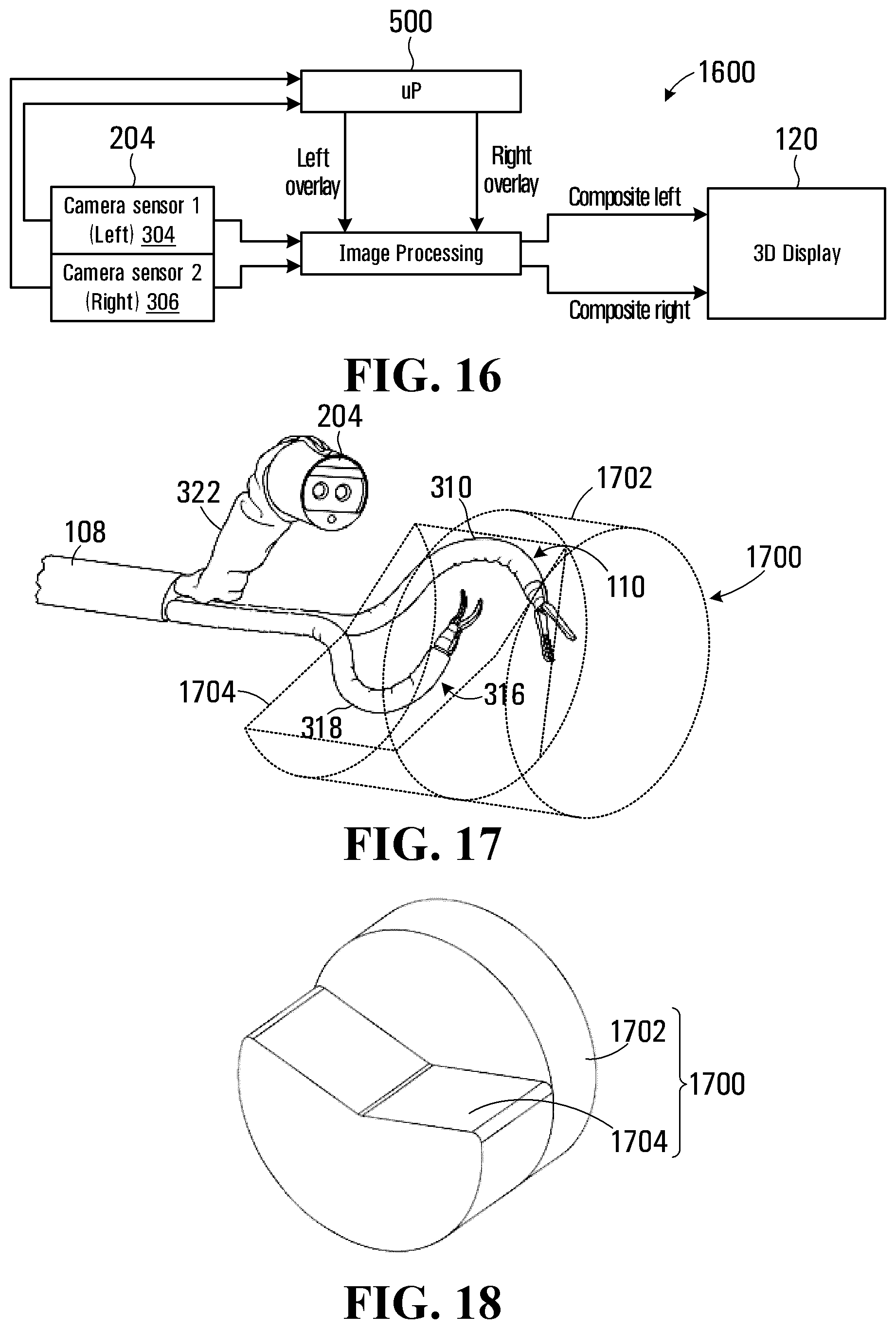 Patent US11779418 Figure 10 – System and apparatus for positioning an instrument in a body cavity for performing a surgical procedure