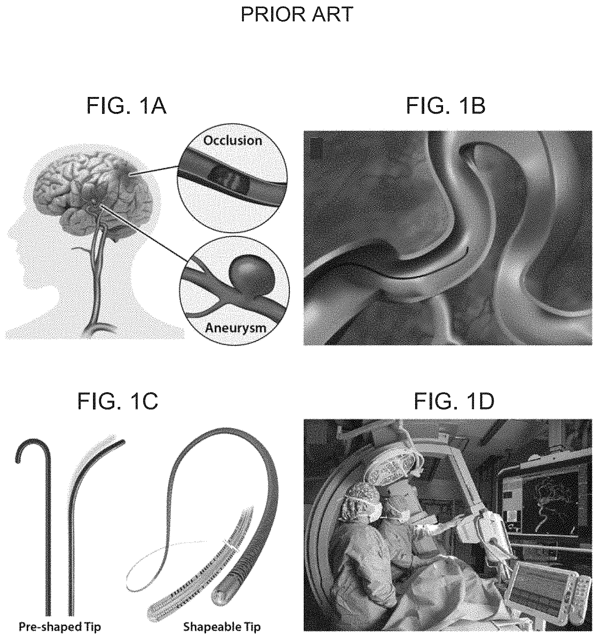 Patent US11779422 Figure 1 – Magnetically steerable continuum robotic guidewires for neurovascular applications