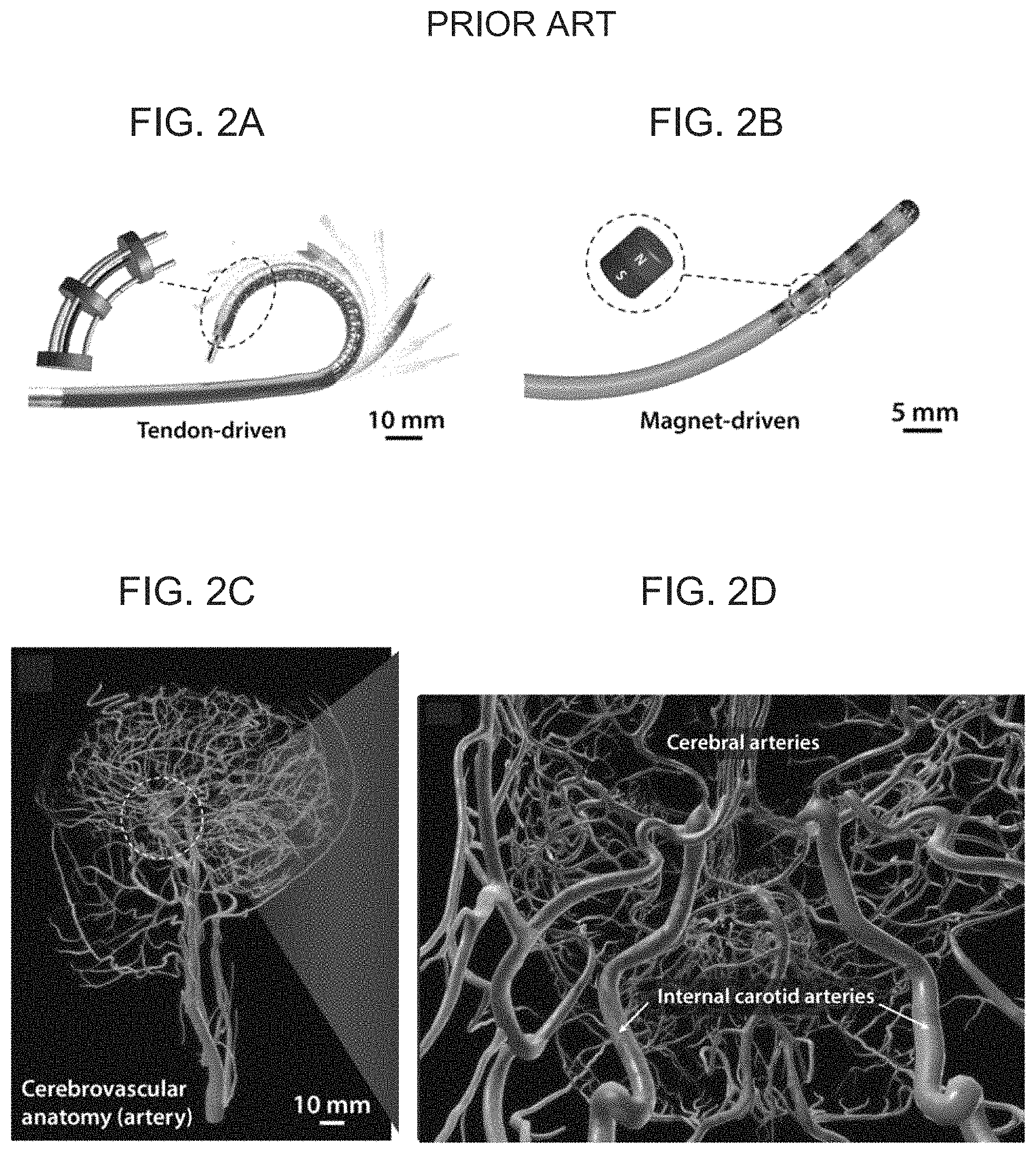 Patent US11779422 Figure 2 – Magnetically steerable continuum robotic guidewires for neurovascular applications