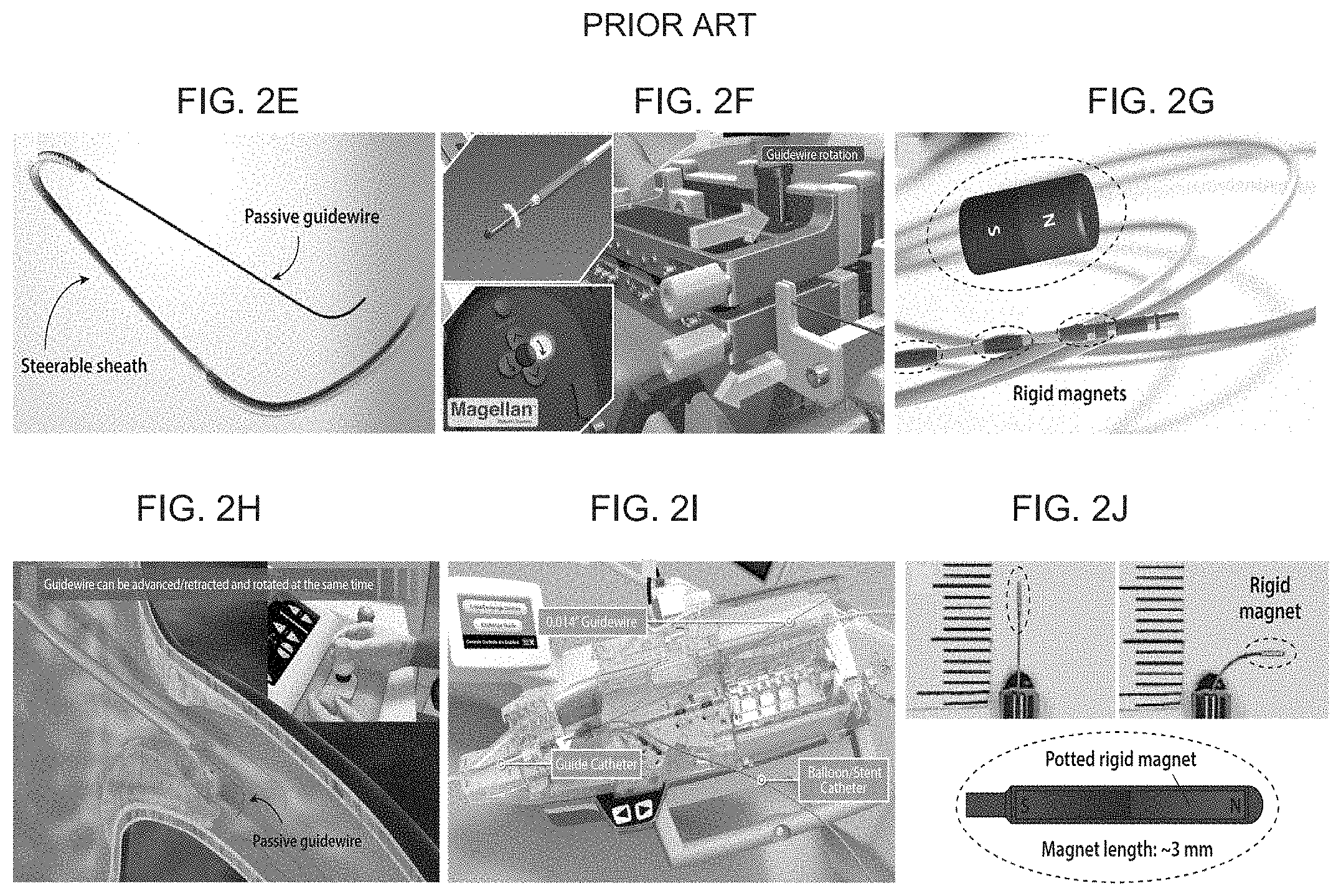 Patent US11779422 Figure 3 – Magnetically steerable continuum robotic guidewires for neurovascular applications