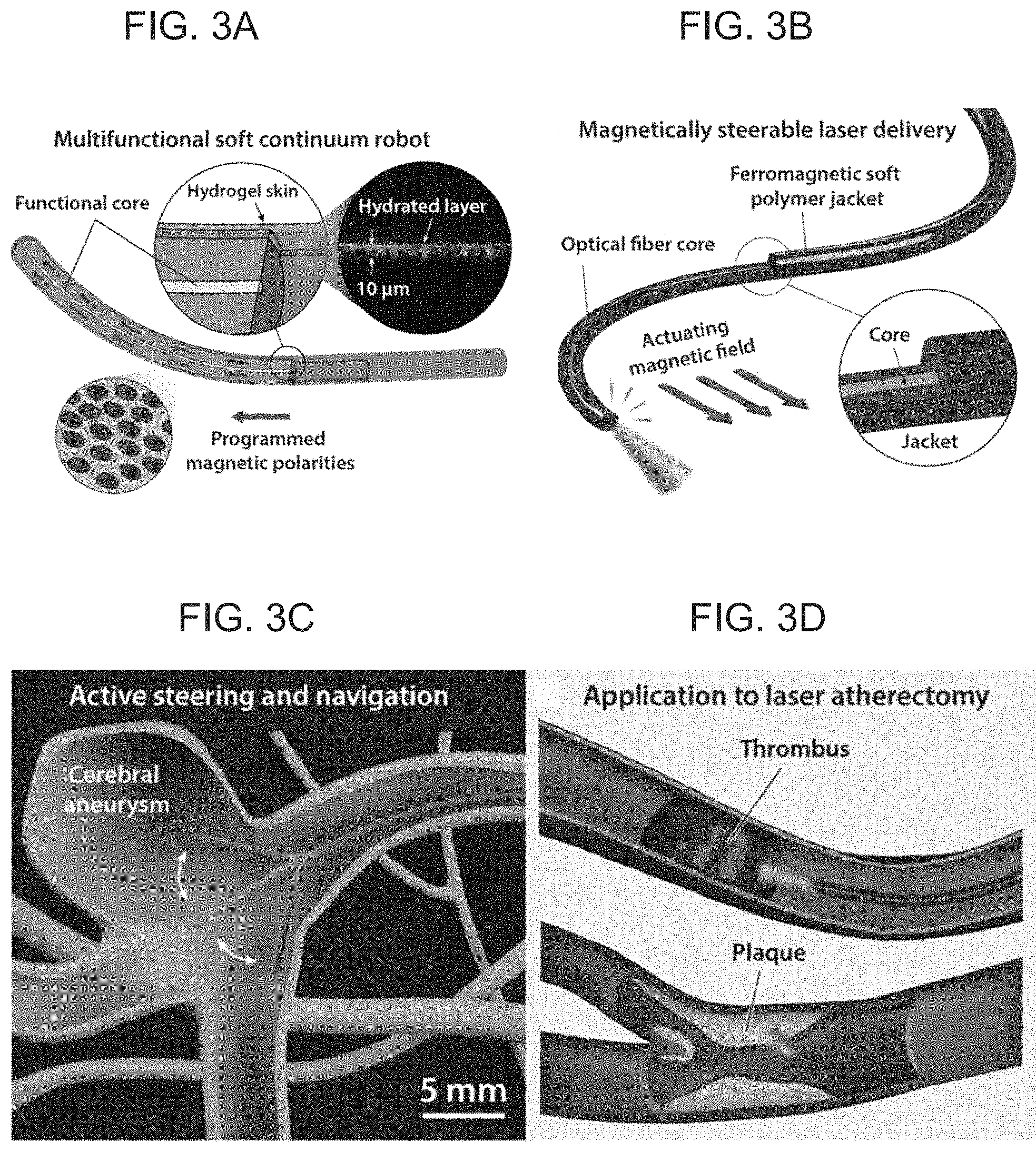 Patent US11779422 Figure 4 – Magnetically steerable continuum robotic guidewires for neurovascular applications