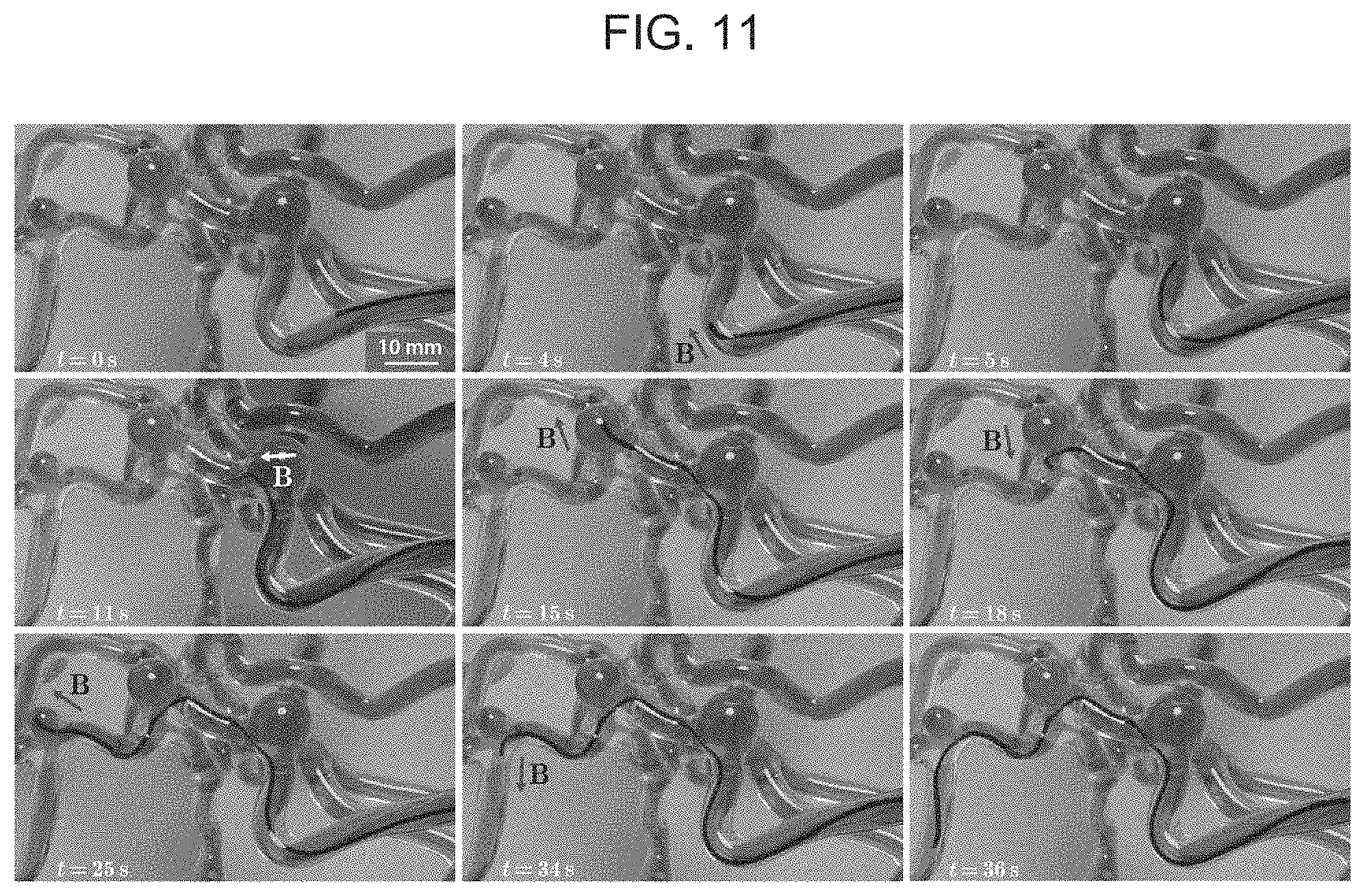 Patent US11779422 Figure 14 – Magnetically steerable continuum robotic guidewires for neurovascular applications