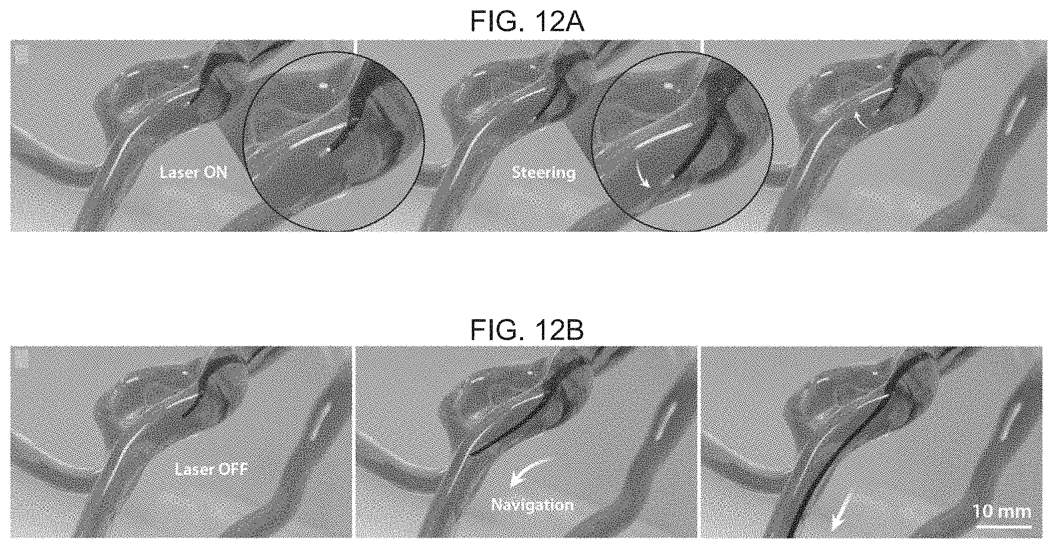 Patent US11779422 Figure 15 – Magnetically steerable continuum robotic guidewires for neurovascular applications