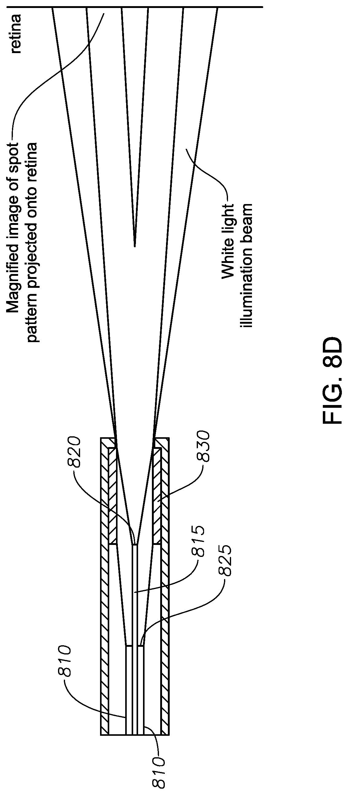 Patent US11779427 Figure 15 – Multiple-input-coupled illuminated multi-spot laser probe
