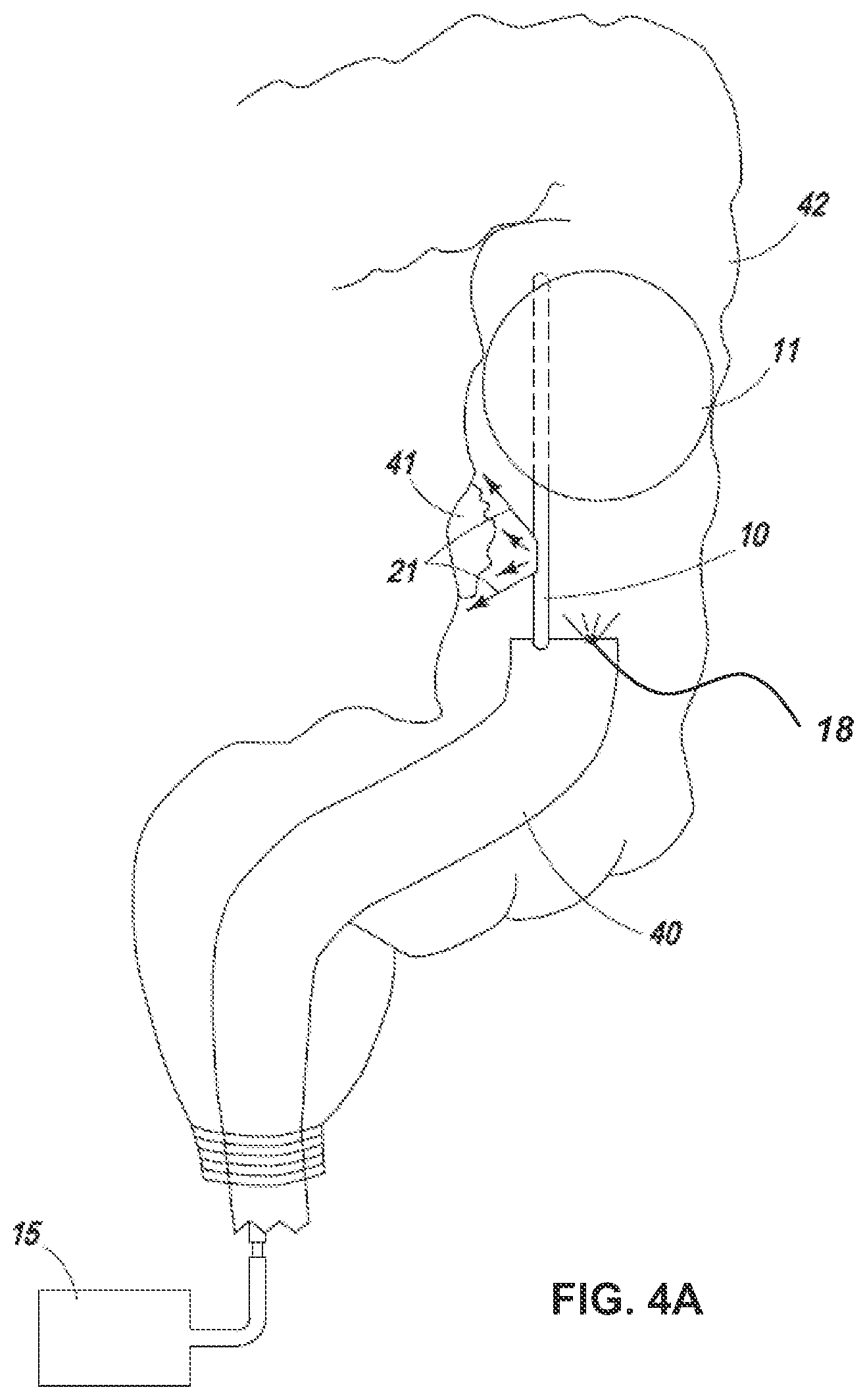 Patent US11779430 Figure 15 – Vapor based ablation system for treating uterine bleeding