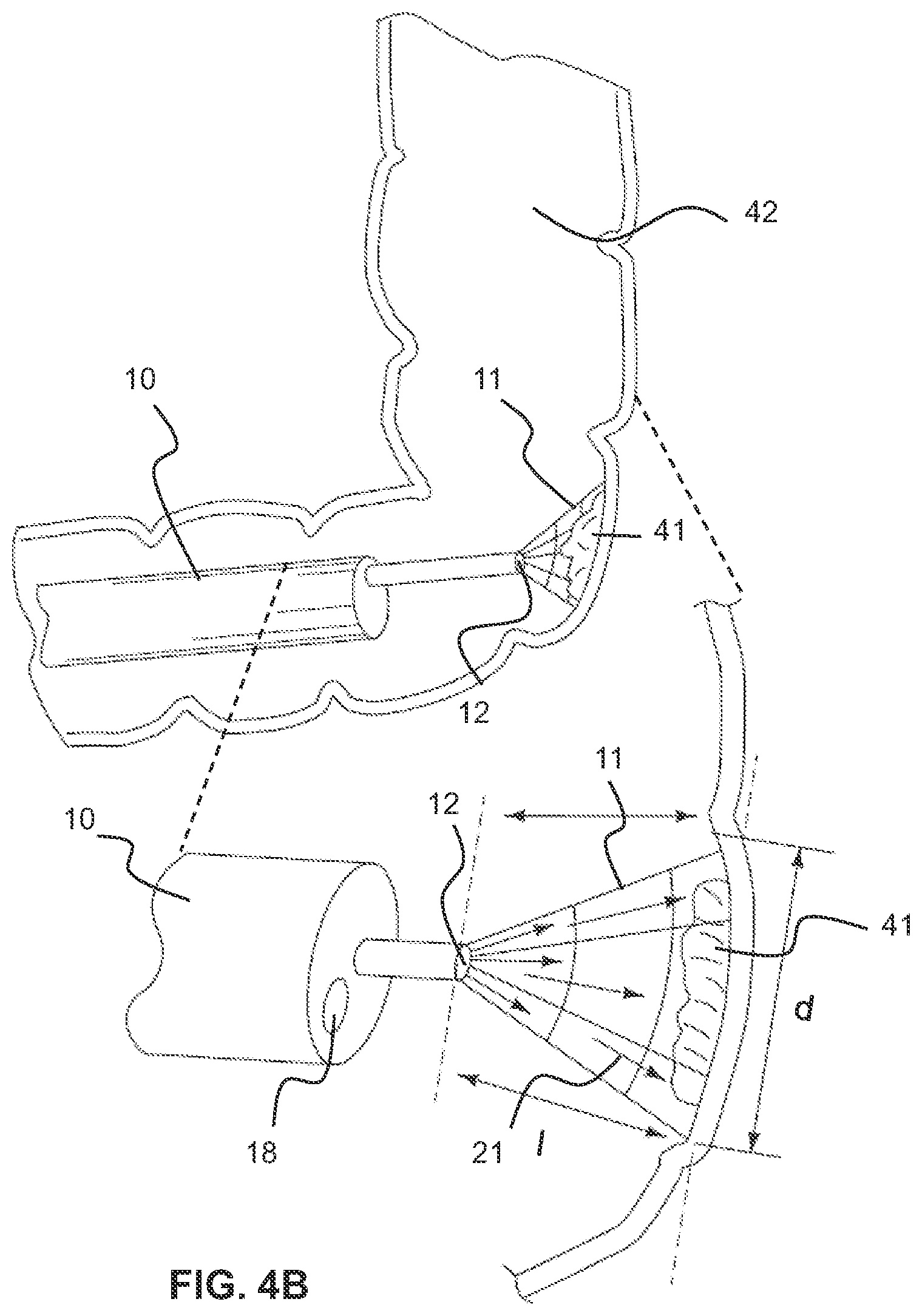 Patent US11779430 Figure 16 – Vapor based ablation system for treating uterine bleeding