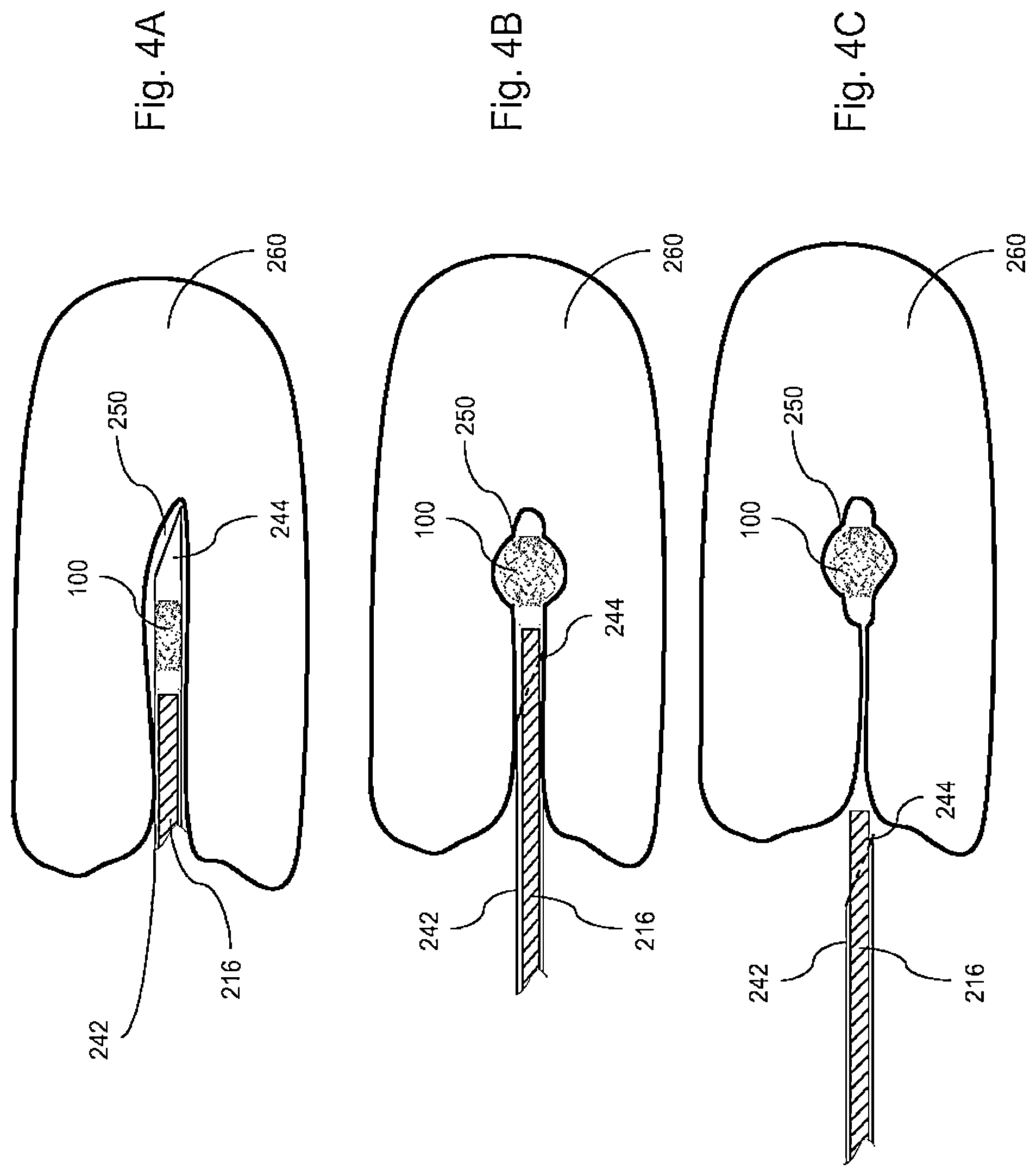 Patent US11779432 Figure 4 – Marking device and implantation system