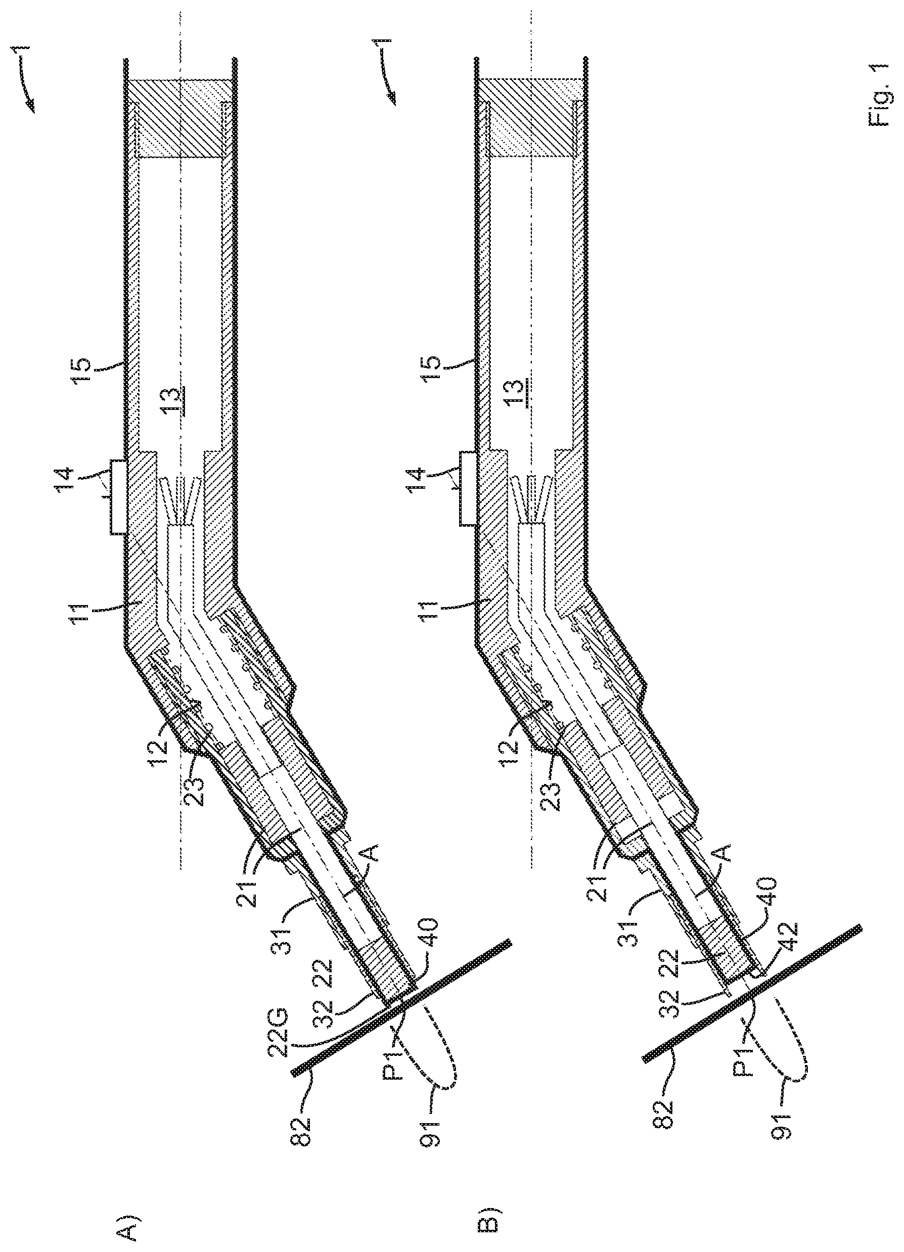 Patent US11779433 Figure 1 – Device for exposing an implant base body