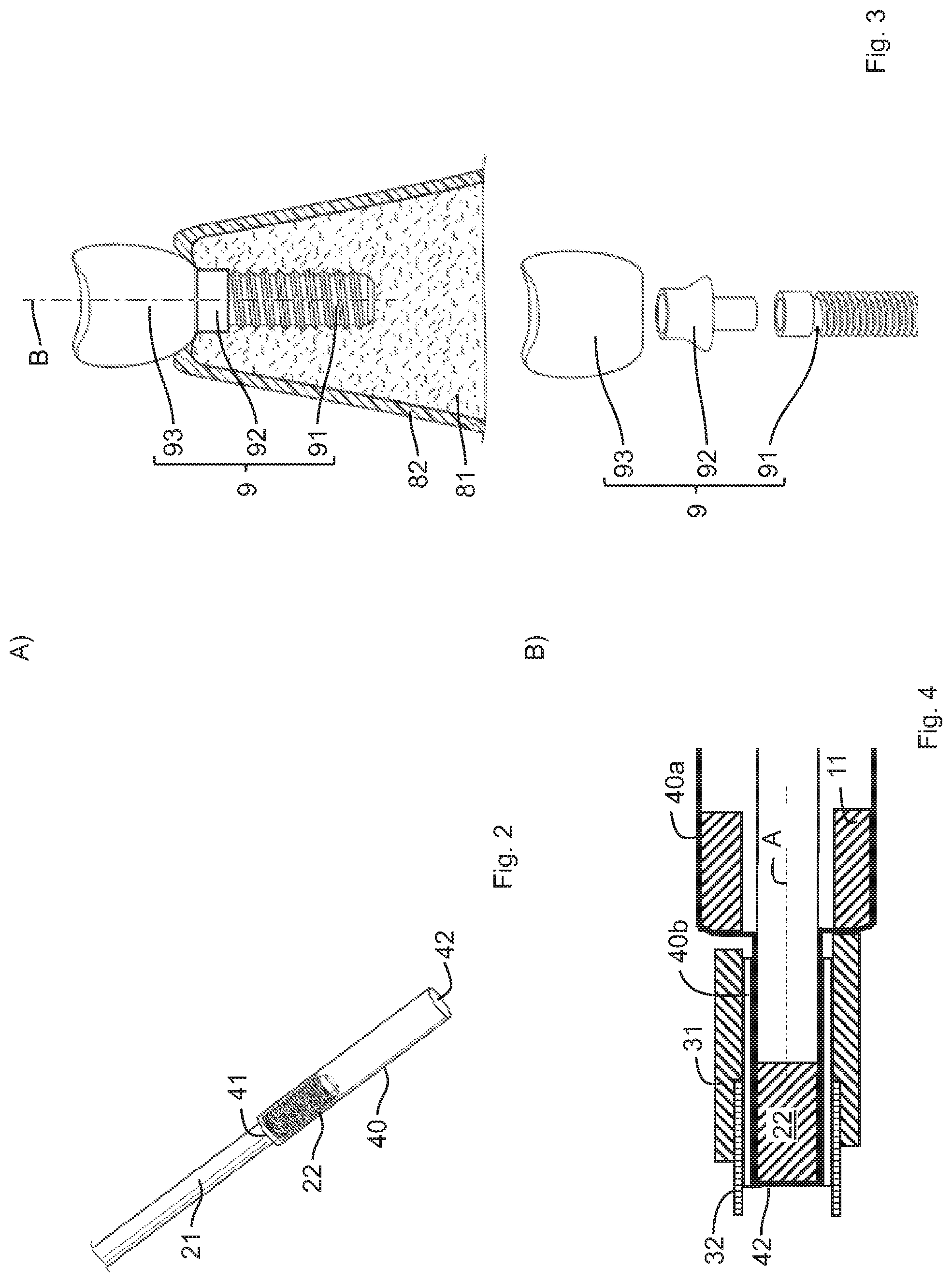 Patent US11779433 Figure 2 – Device for exposing an implant base body