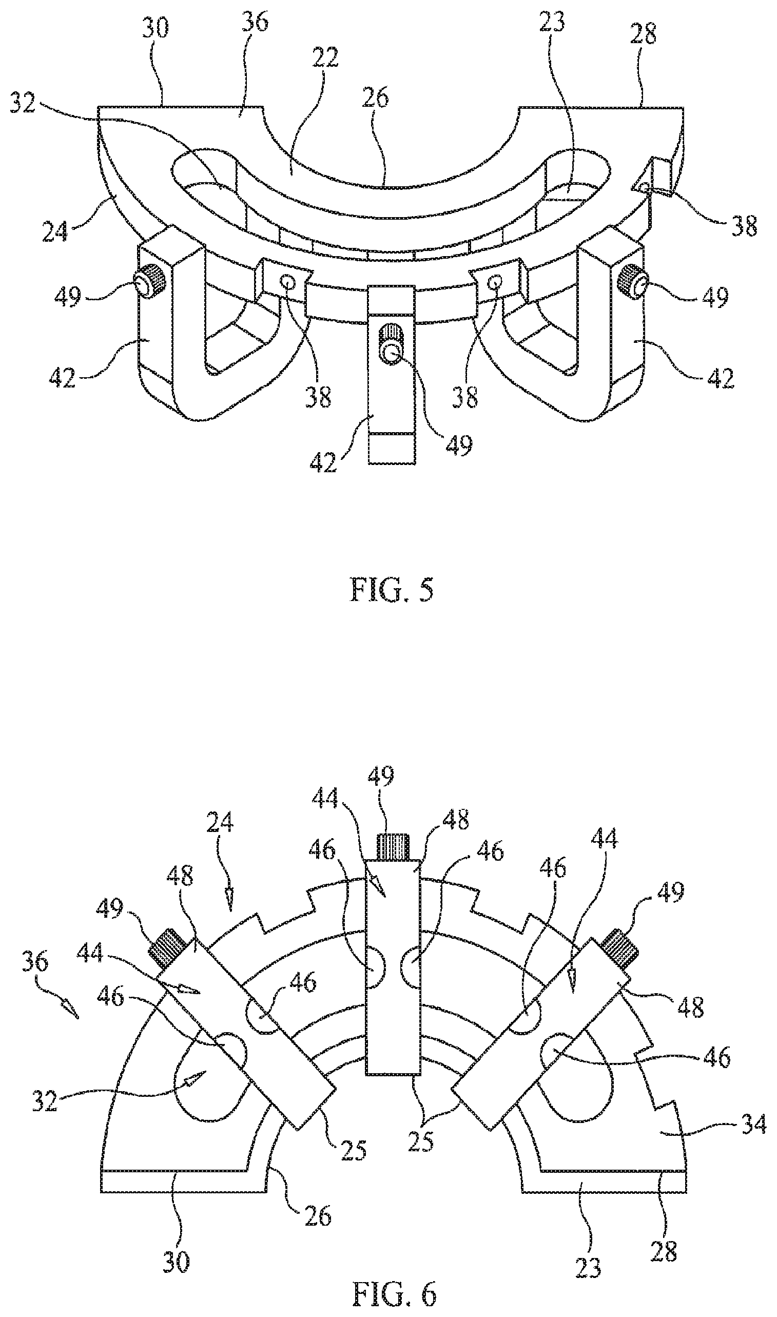 Patent US11779434 Figure 3 – Bone foundation guide system and method
