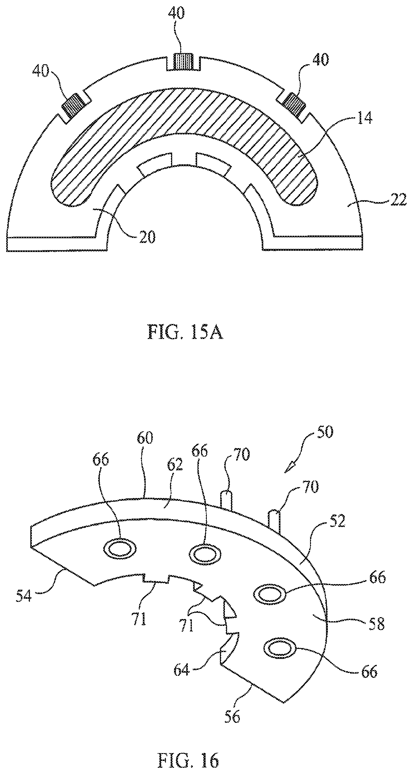 Patent US11779434 Figure 9 – Bone foundation guide system and method