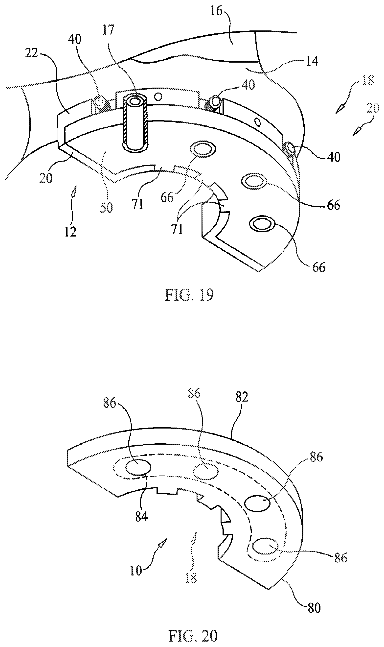 Patent US11779434 Figure 11 – Bone foundation guide system and method