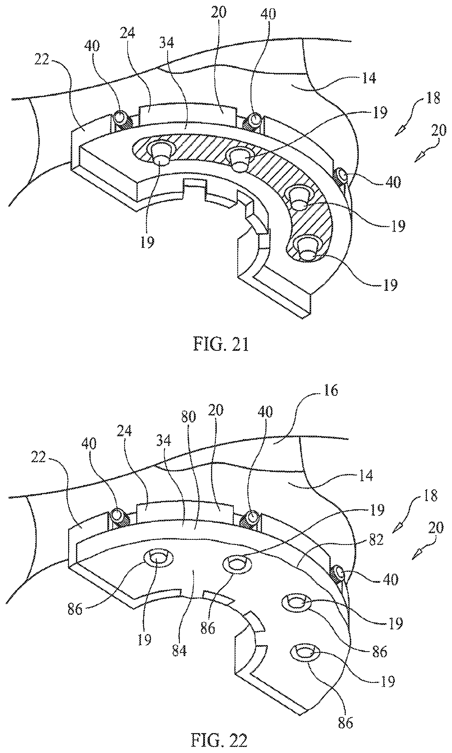 Patent US11779434 Figure 12 – Bone foundation guide system and method