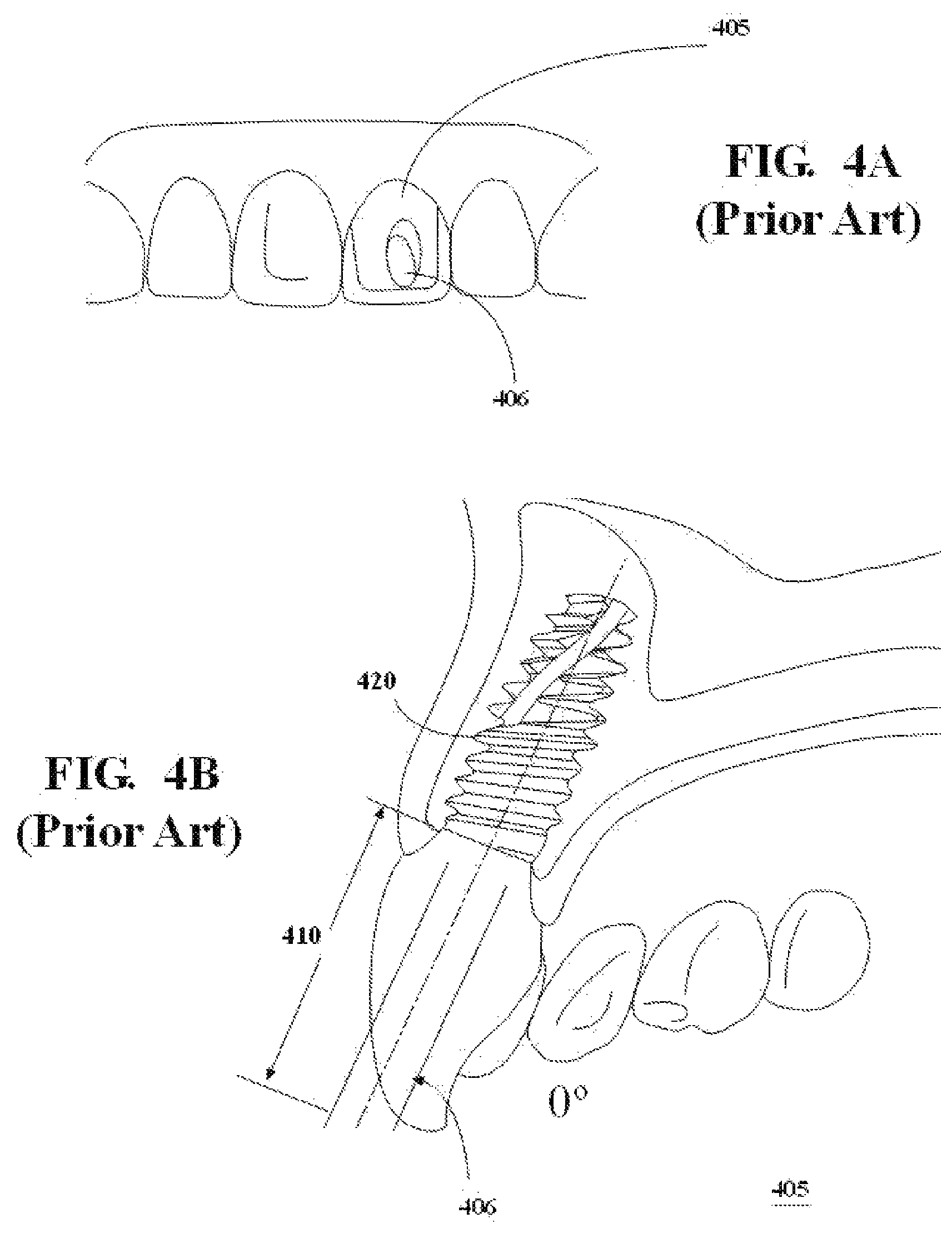 Patent US11779435 Figure 4 – Dental screwdriver
