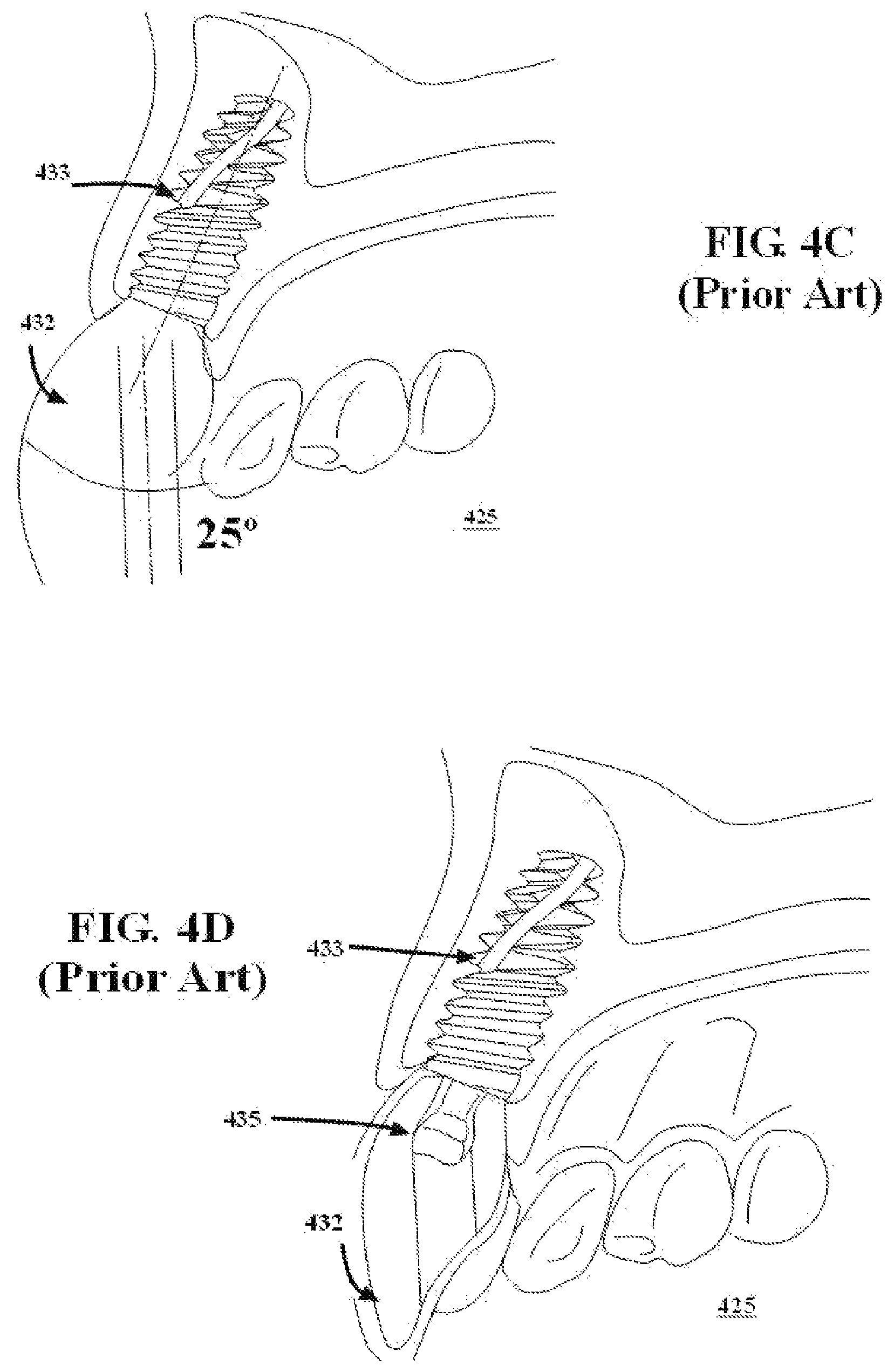 Patent US11779435 Figure 5 – Dental screwdriver