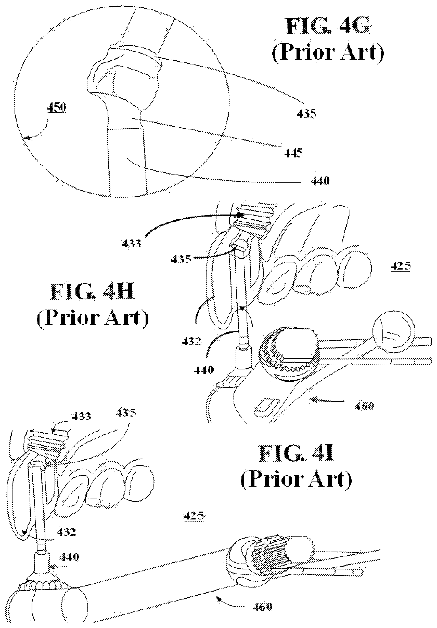 Patent US11779435 Figure 7 – Dental screwdriver