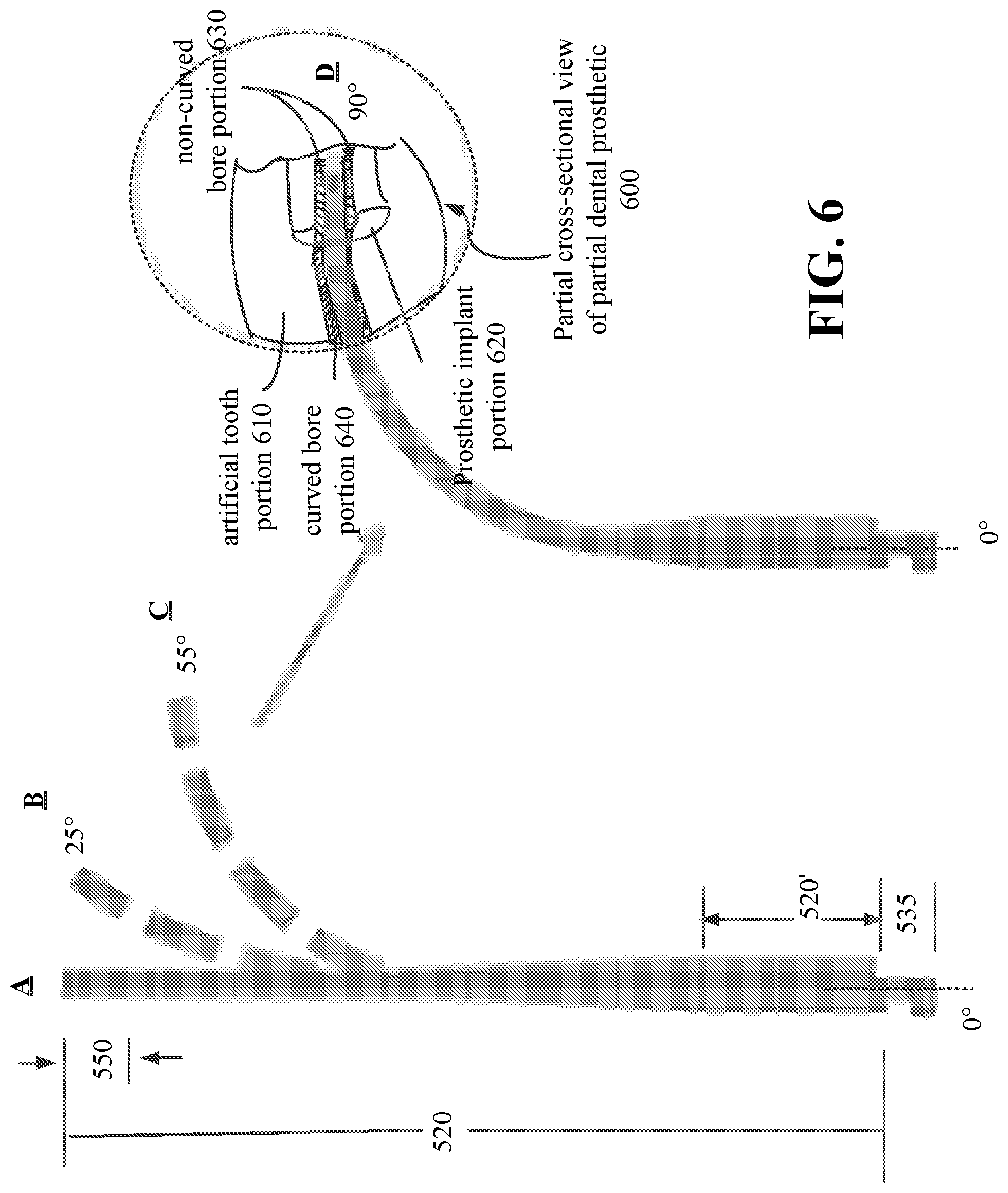 Patent US11779435 Figure 9 – Dental screwdriver