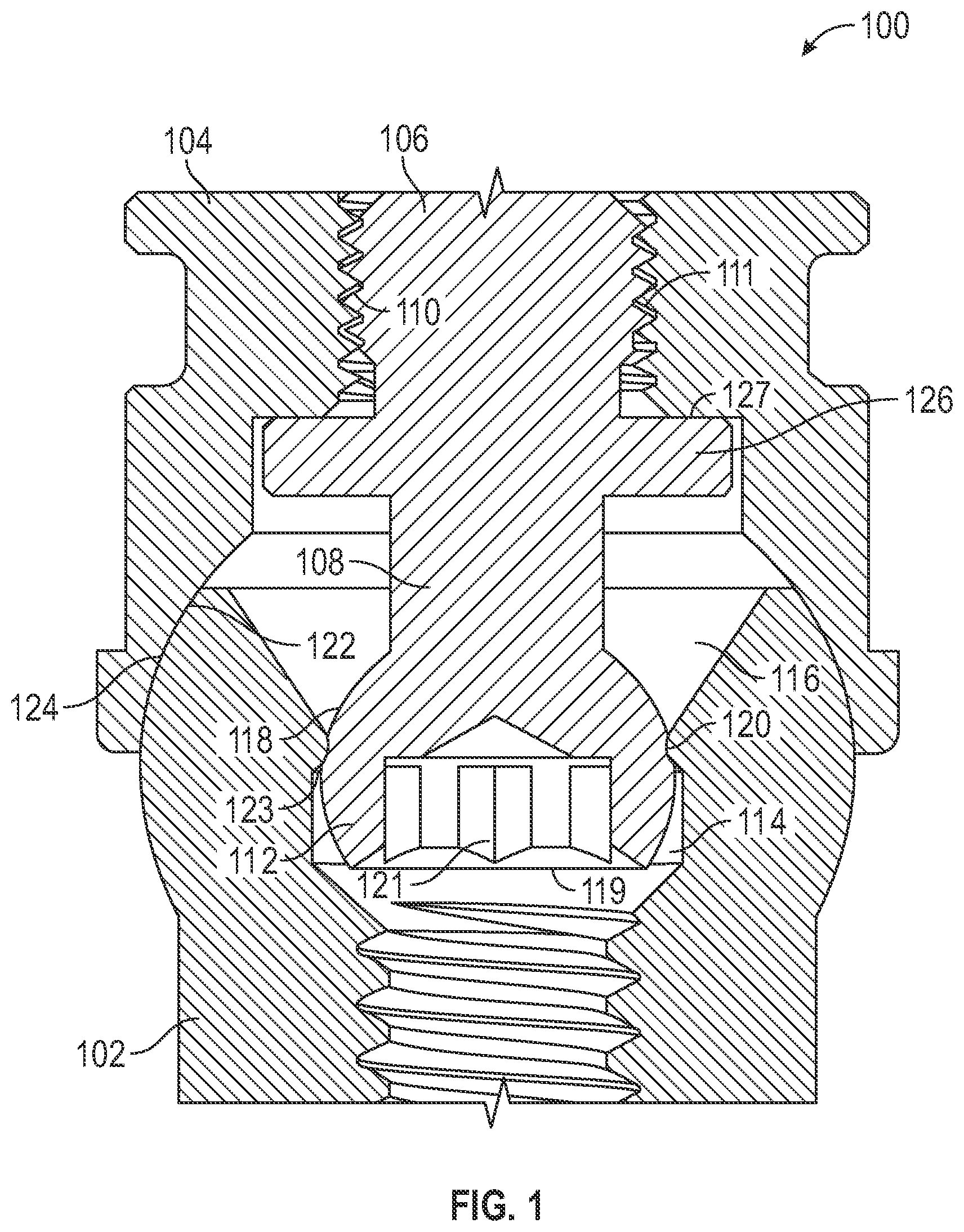 Patent US11779438 Figure 1 – Fixed hybrid dental attachment assembly and methods of use