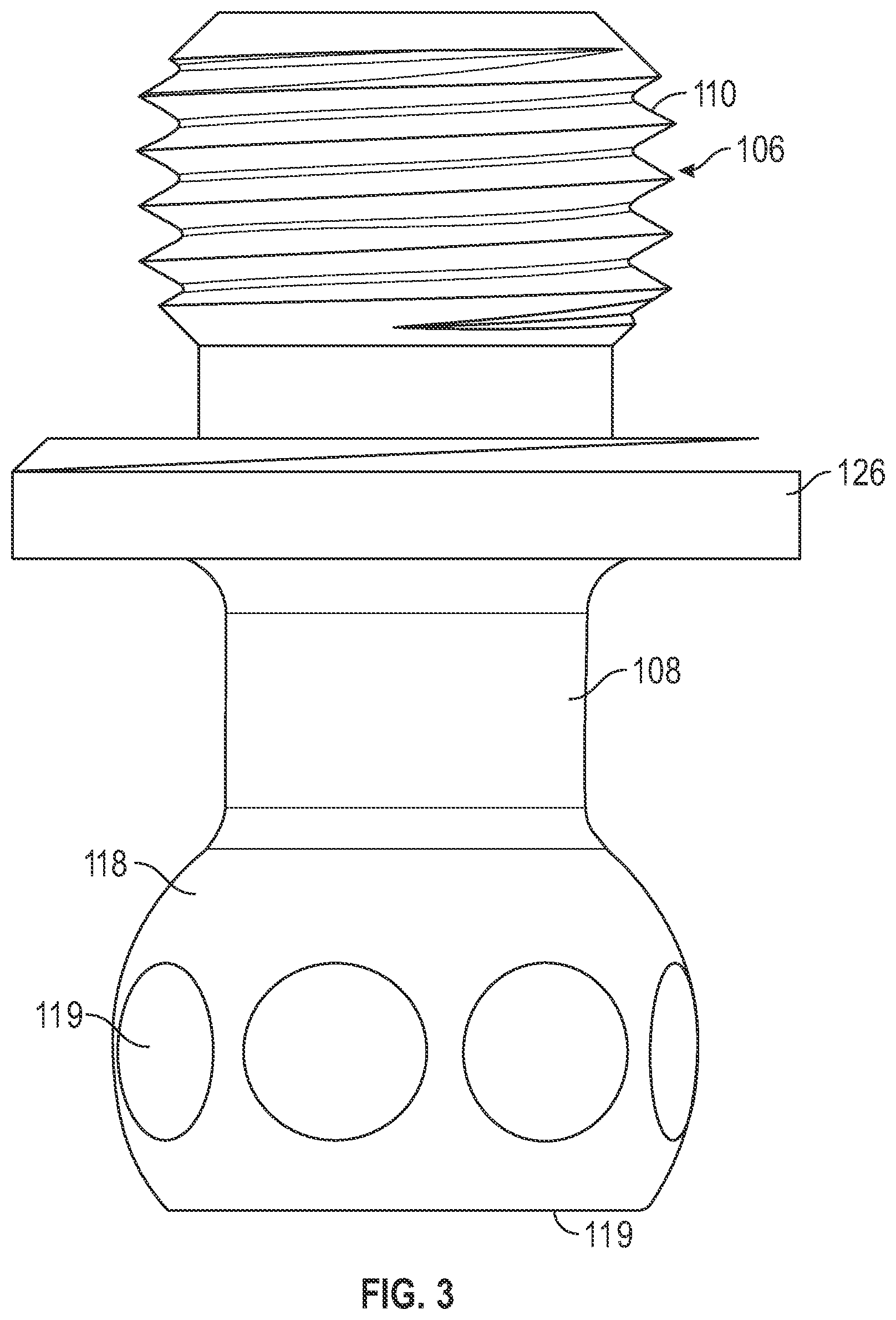 Patent US11779438 Figure 3 – Fixed hybrid dental attachment assembly and methods of use