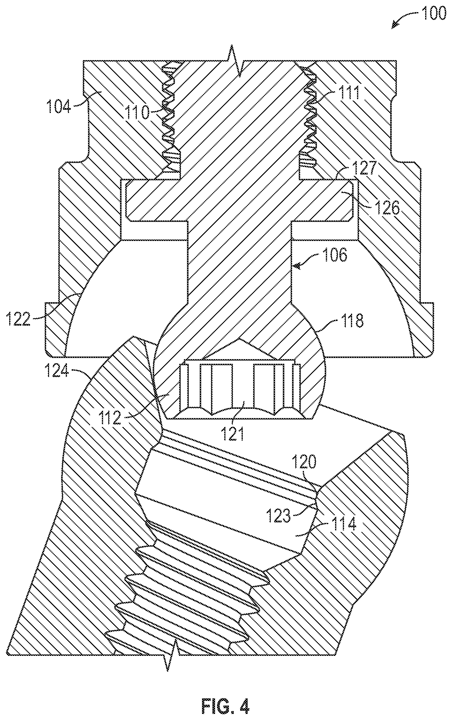 Patent US11779438 Figure 4 – Fixed hybrid dental attachment assembly and methods of use