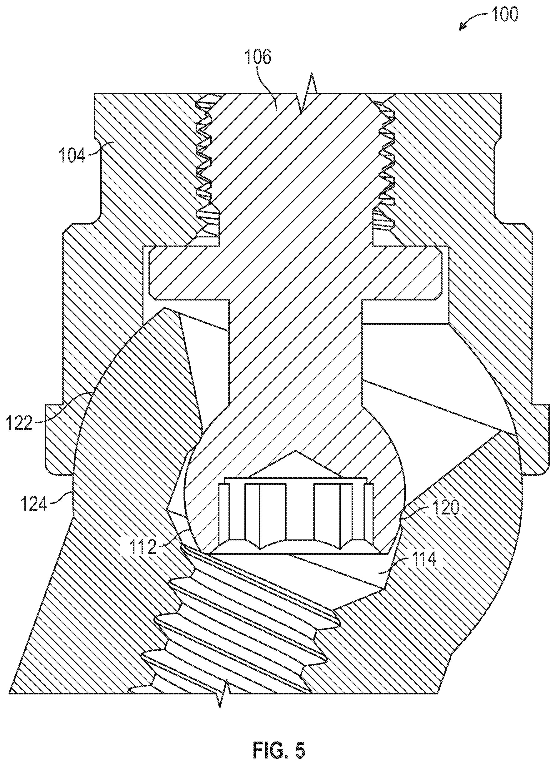 Patent US11779438 Figure 5 – Fixed hybrid dental attachment assembly and methods of use