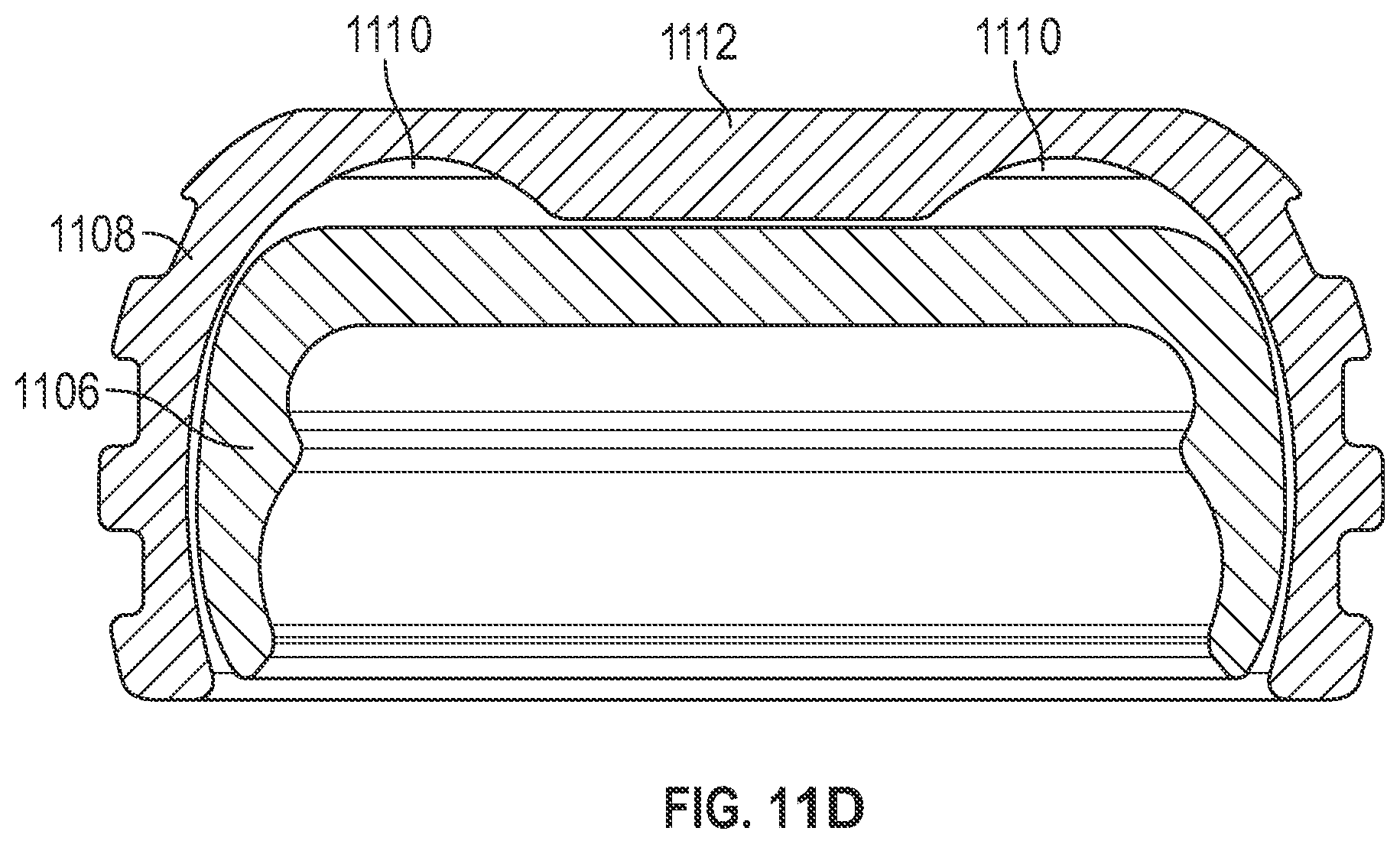 Patent US11779438 Figure 9 – Fixed hybrid dental attachment assembly and methods of use
