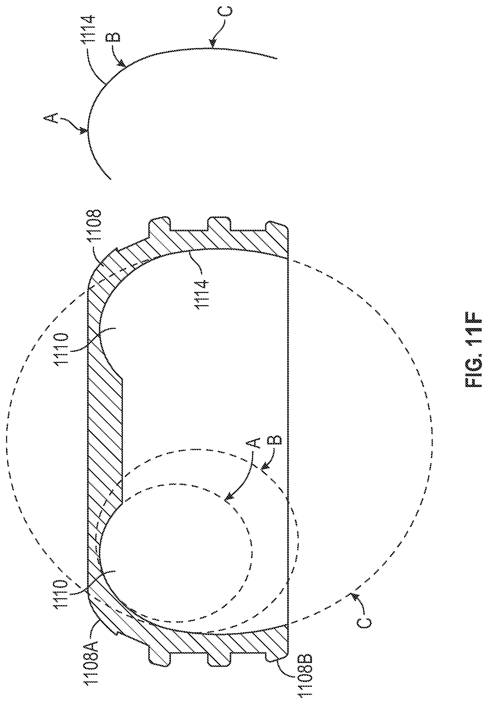 Patent US11779438 Figure 11 – Fixed hybrid dental attachment assembly and methods of use