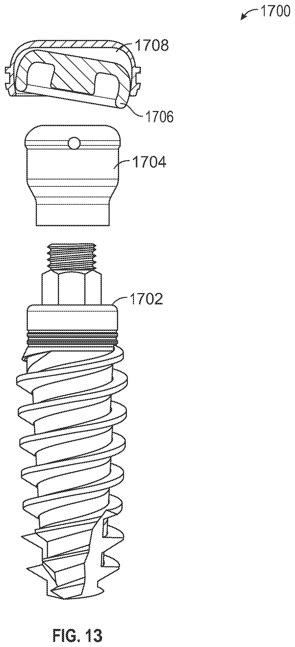 Patent US11779438 Figure 14 – Fixed hybrid dental attachment assembly and methods of use