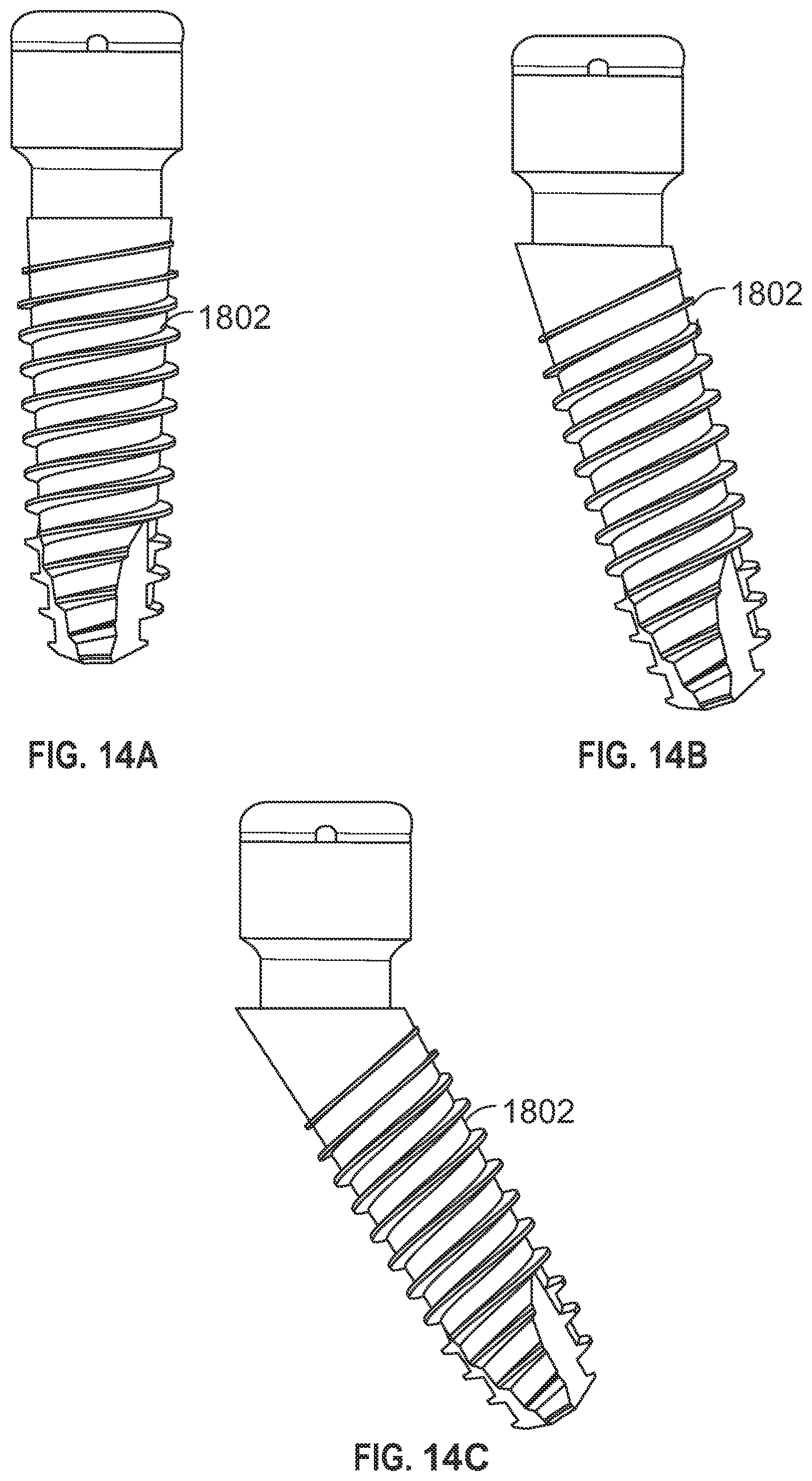 Patent US11779438 Figure 15 – Fixed hybrid dental attachment assembly and methods of use