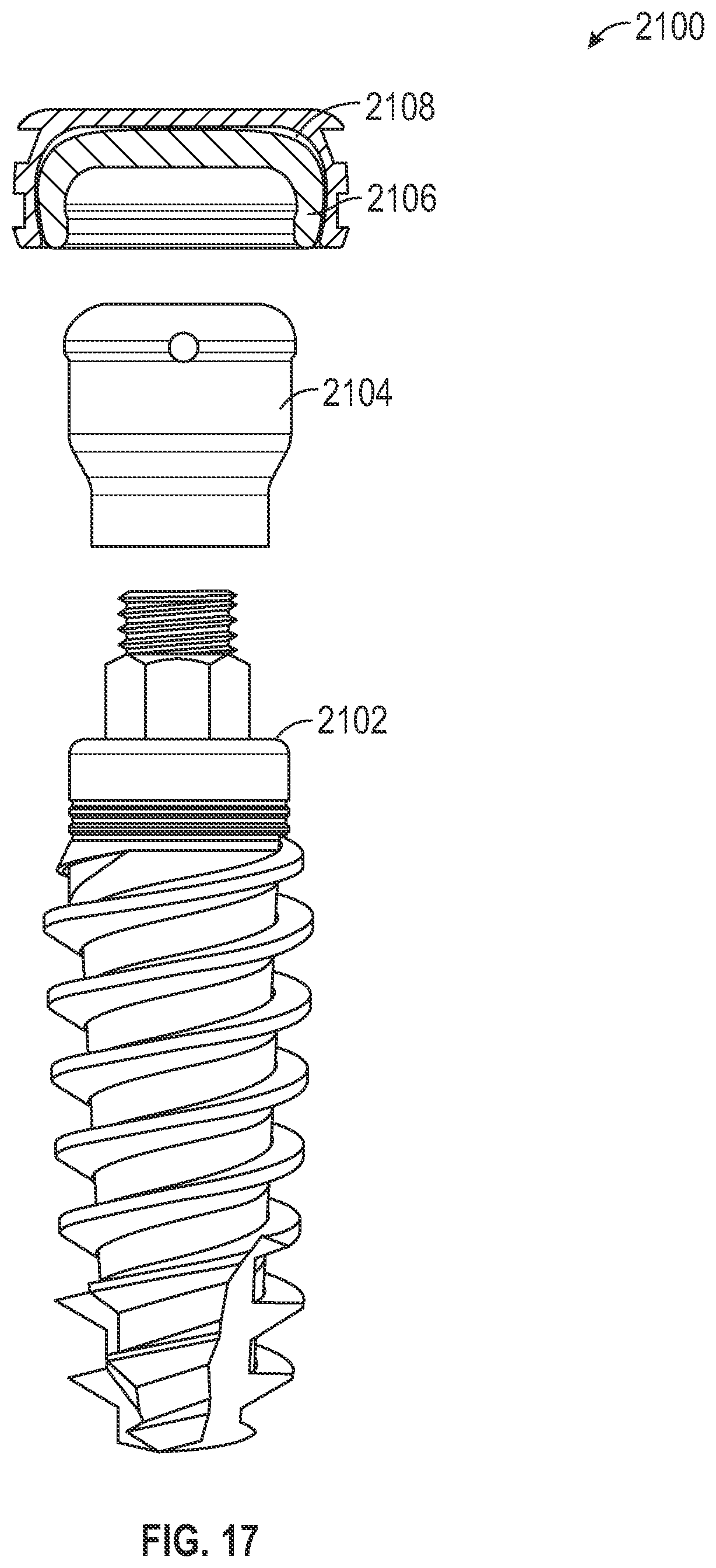 Patent US11779438 Figure 19 – Fixed hybrid dental attachment assembly and methods of use
