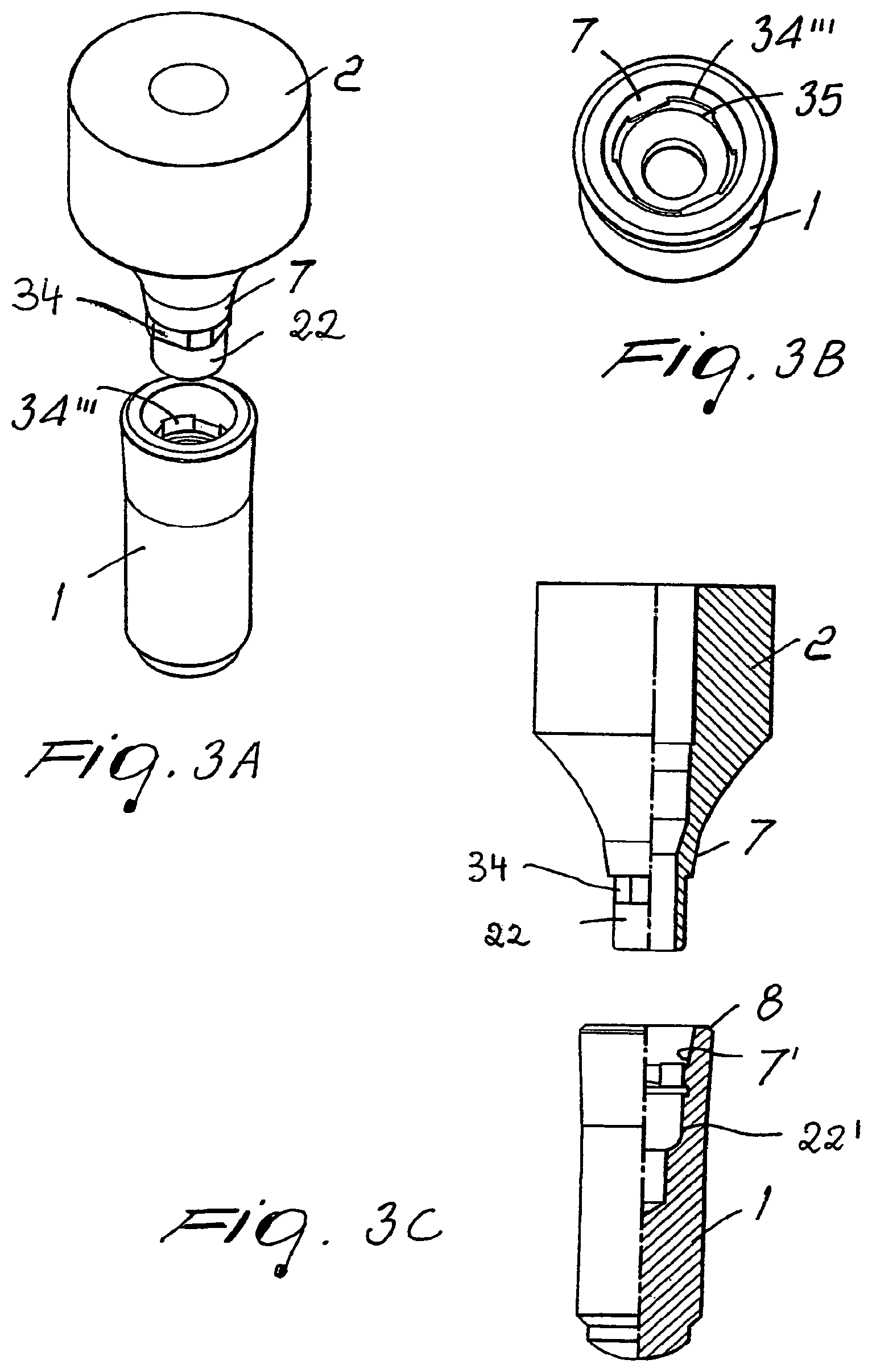 Patent US11779439 Figure 4 – Coupling for a multi-part dental implant system